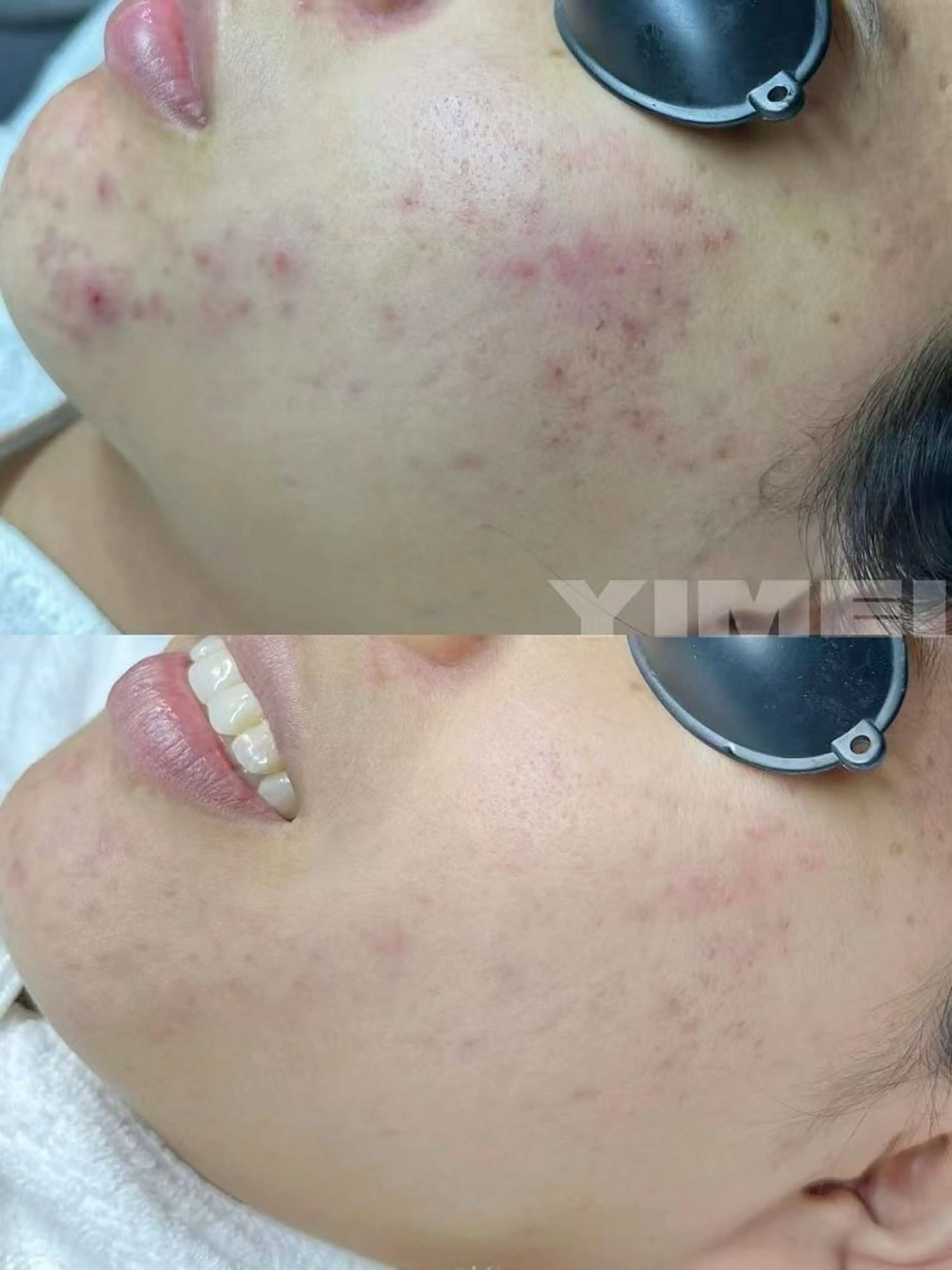 パーマ エステ aliaハイフ&水光ジェットサロン所属・aliaハーブ水光店 エステティシャン募集のエステ・リラクイメージ