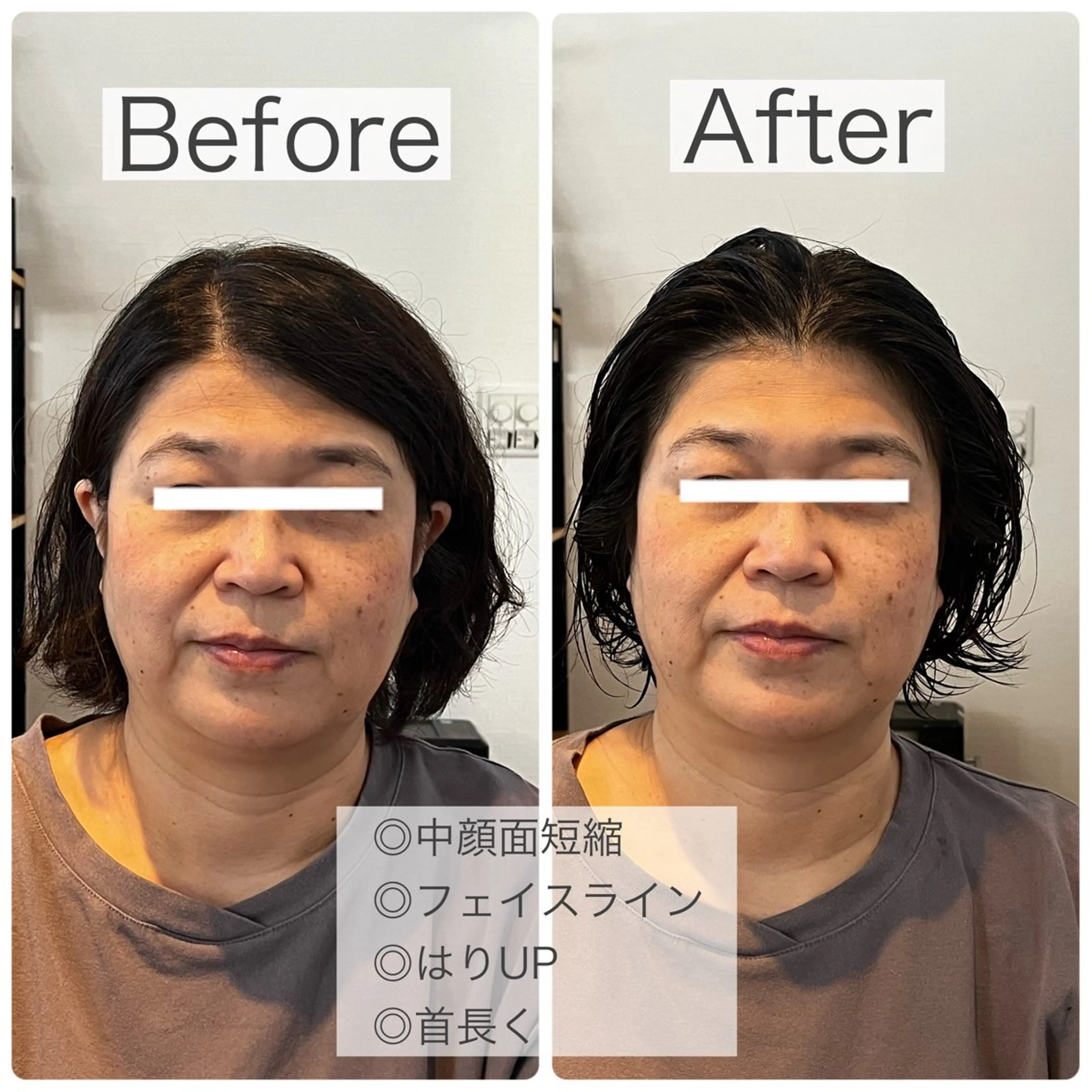 GAGA D  Ash所属・GAGA D Ashのヘアスタイル