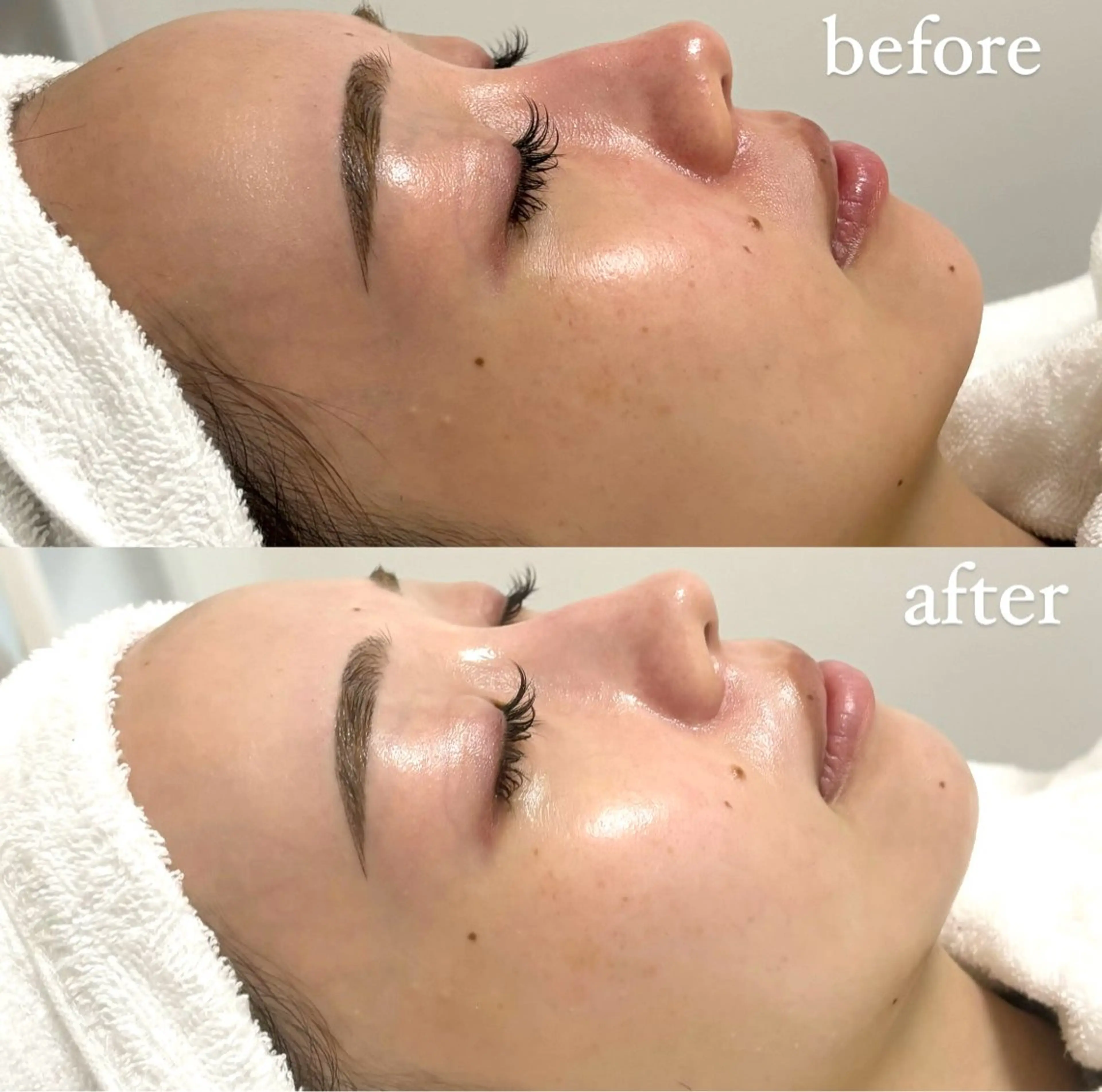 女性専門お顔剃り sunraineのエステ・リラクイメージ