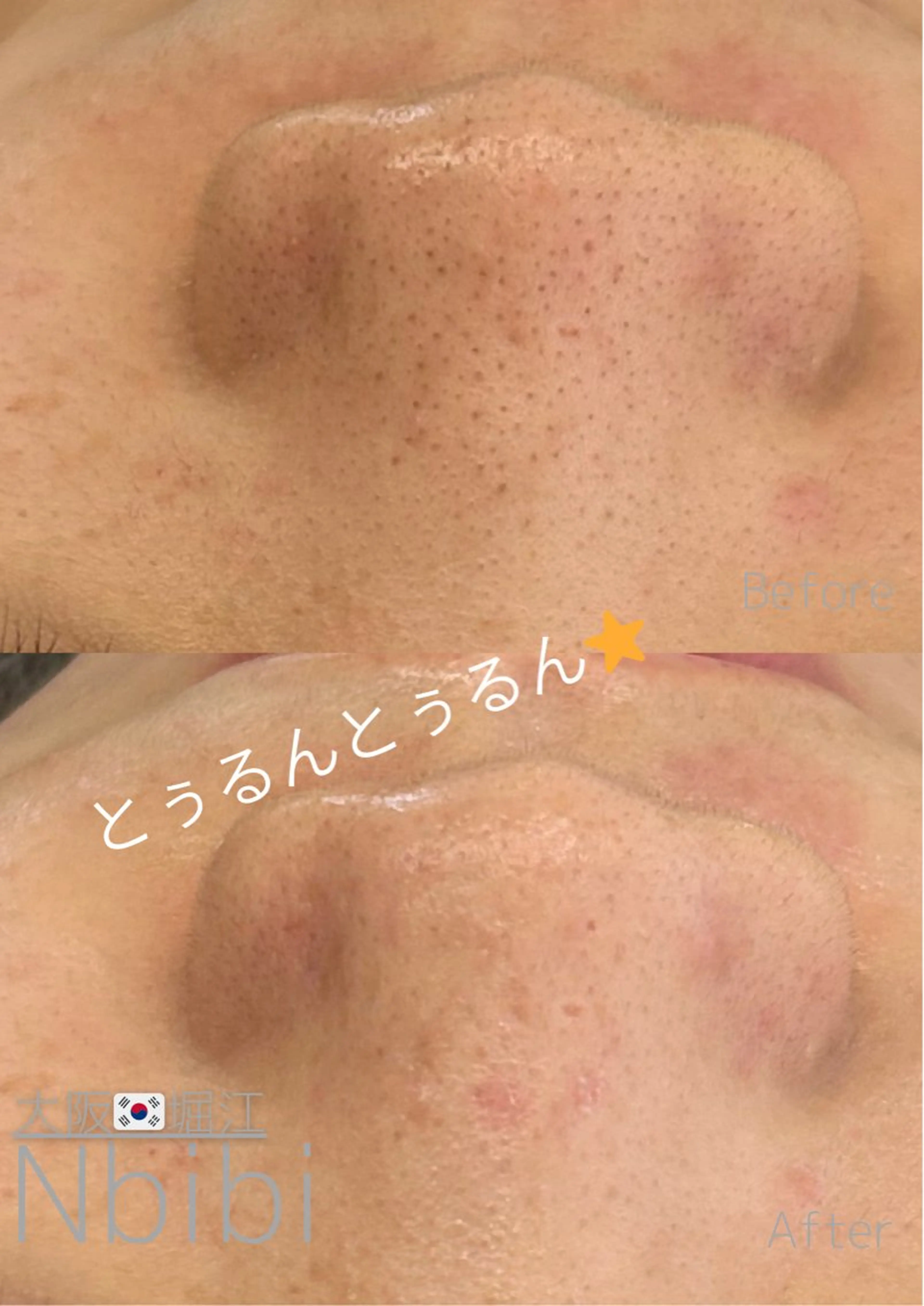 エステ 韓国🇰🇷価格 サロン_Nbibiのエステ・リラクイメージ