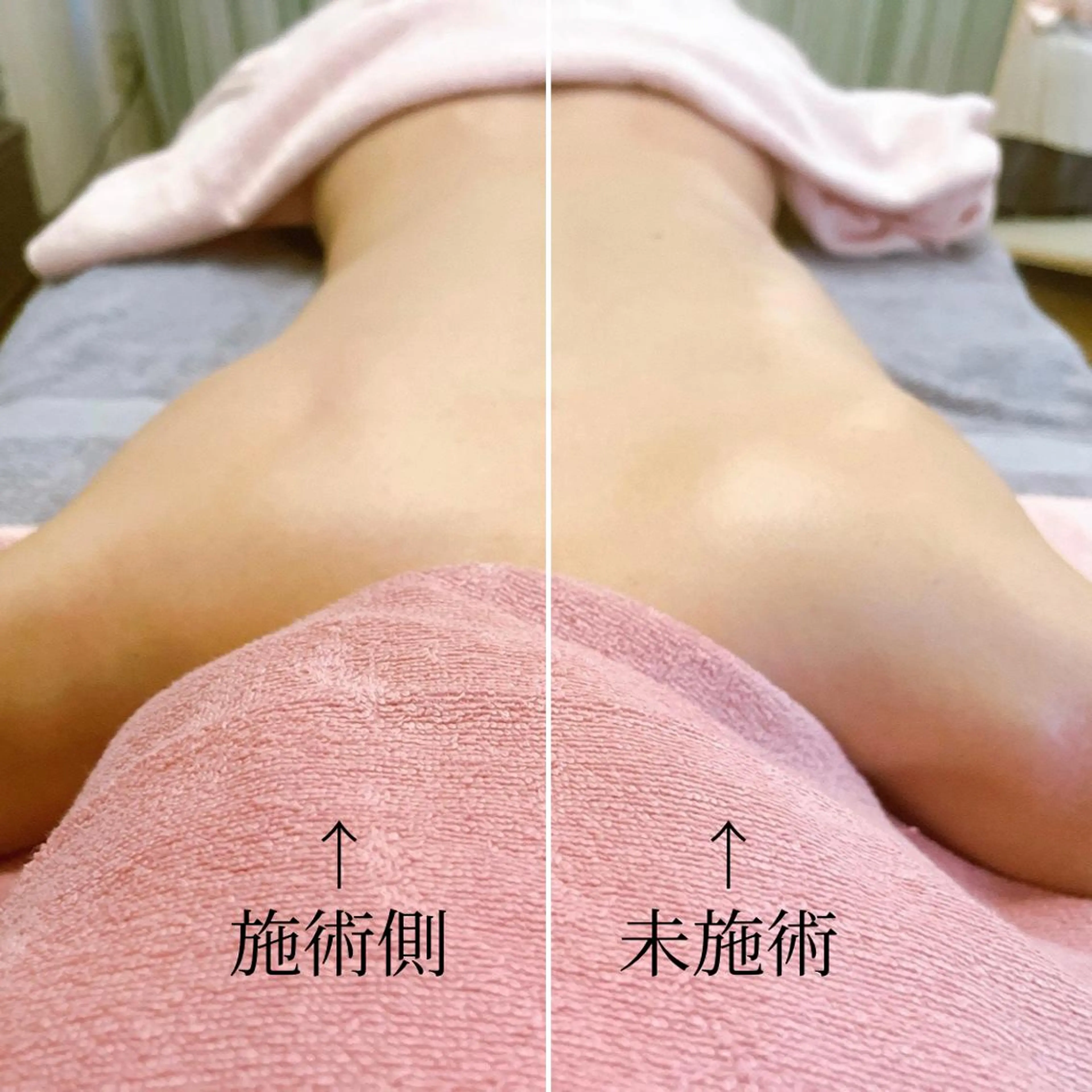 脳疲労を癒して体を 整えるアロマサロンのエステ・リラクイメージ