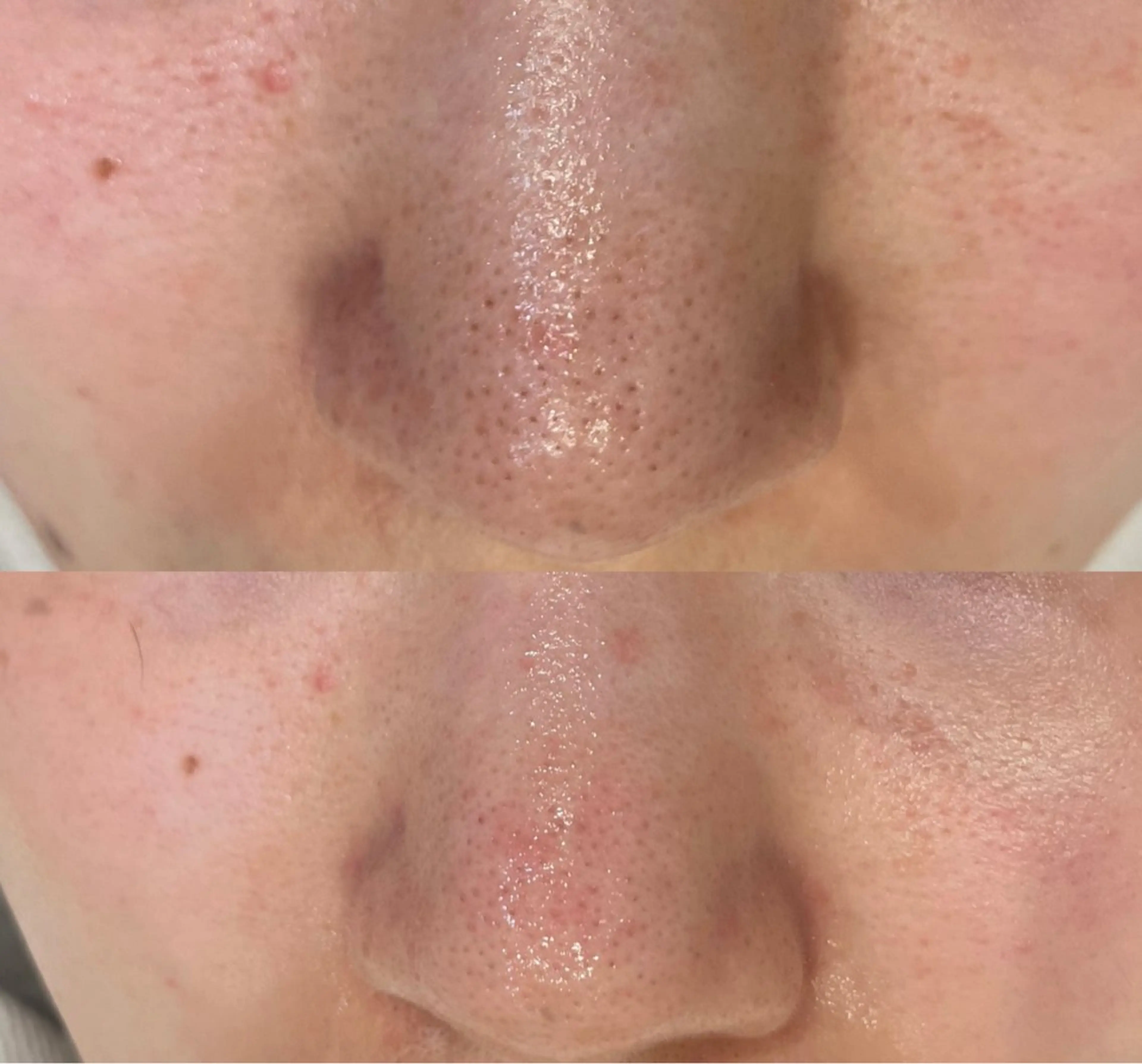 DeI'm   名古屋栄所属・小林 玲菜のエステ・リラクイメージ