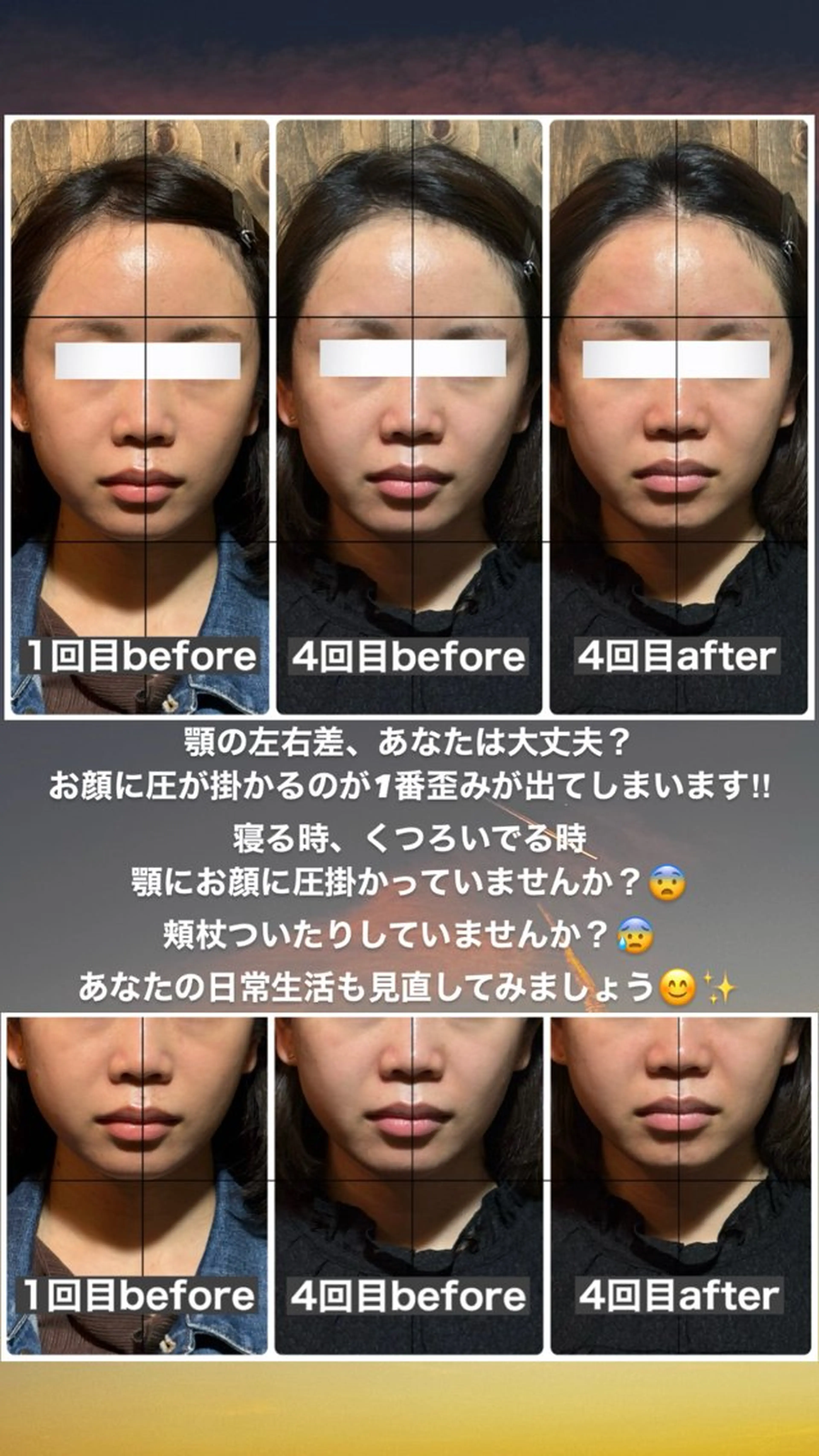 エステ リラク 💎後悔させない小顔 矯正💎イトヤマ🌱のエステ・リラクイメージ