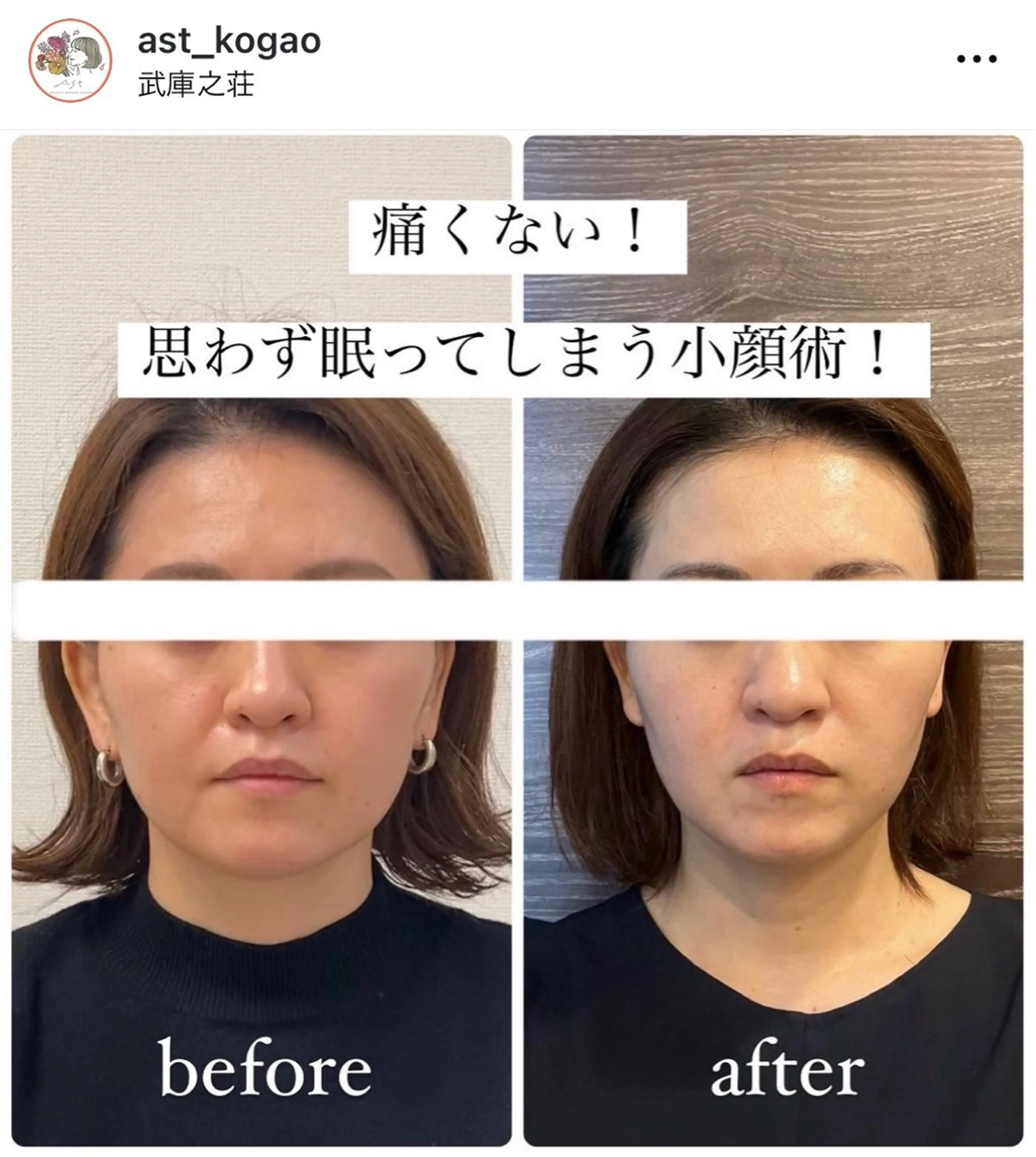 その他 小顔矯正サロンAST【アスト】所属・小顔矯正サロン AST【アスト】のその他イメージ