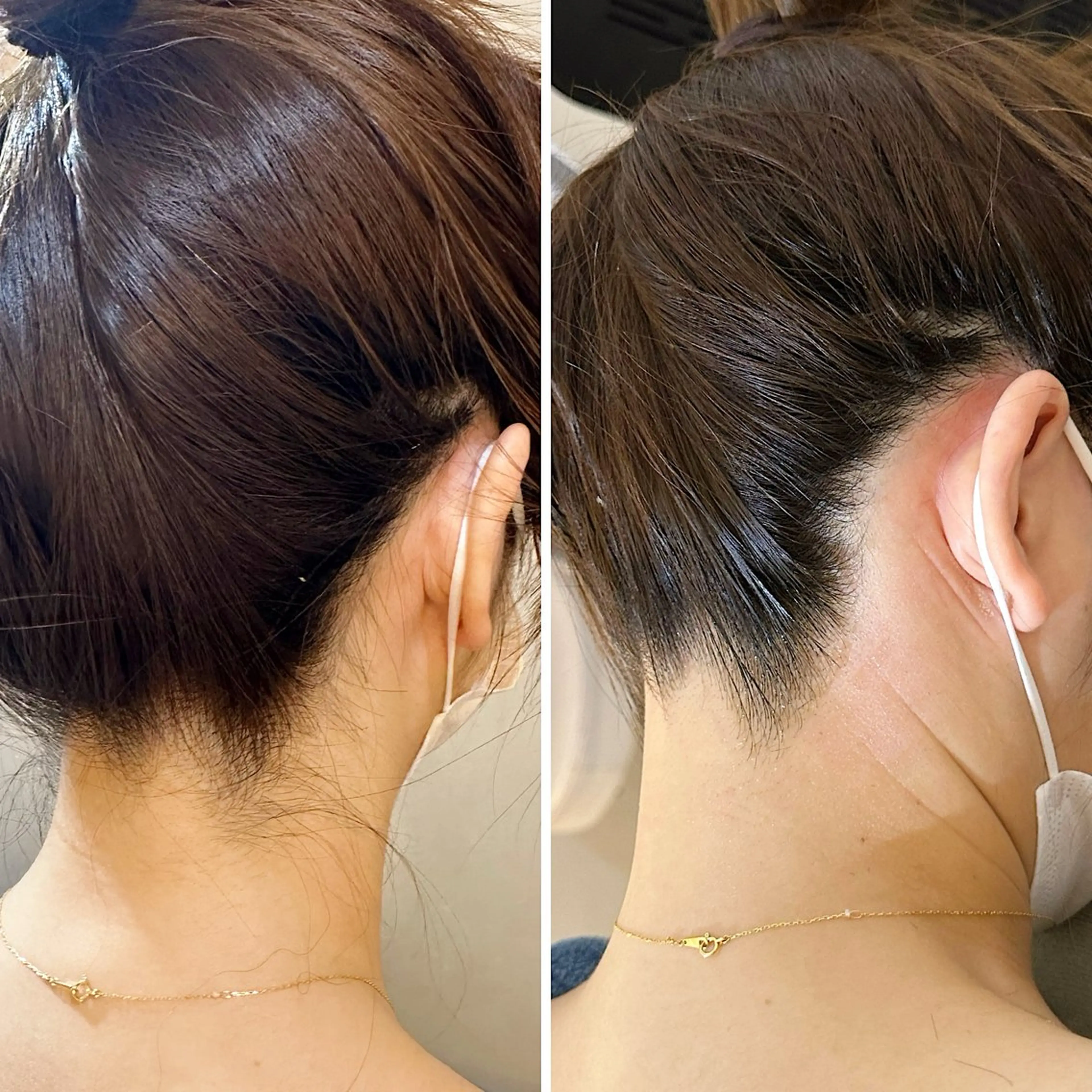 脱毛 うなじ脱毛/美肌脱毛 LABELのエステ・リラクイメージ