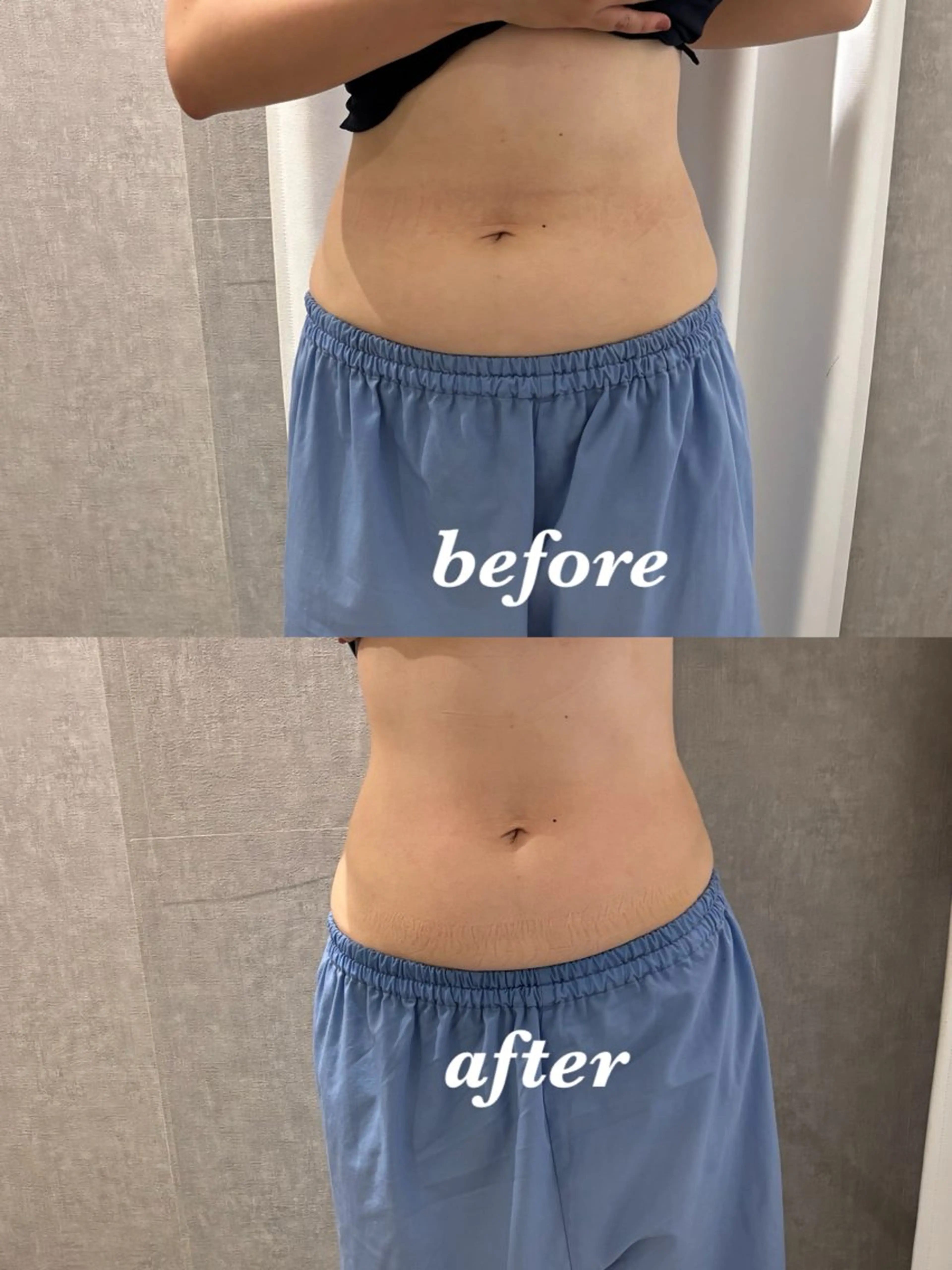 メンズ エステ リラク 腸活サポート みなみののエステ・リラクイメージ