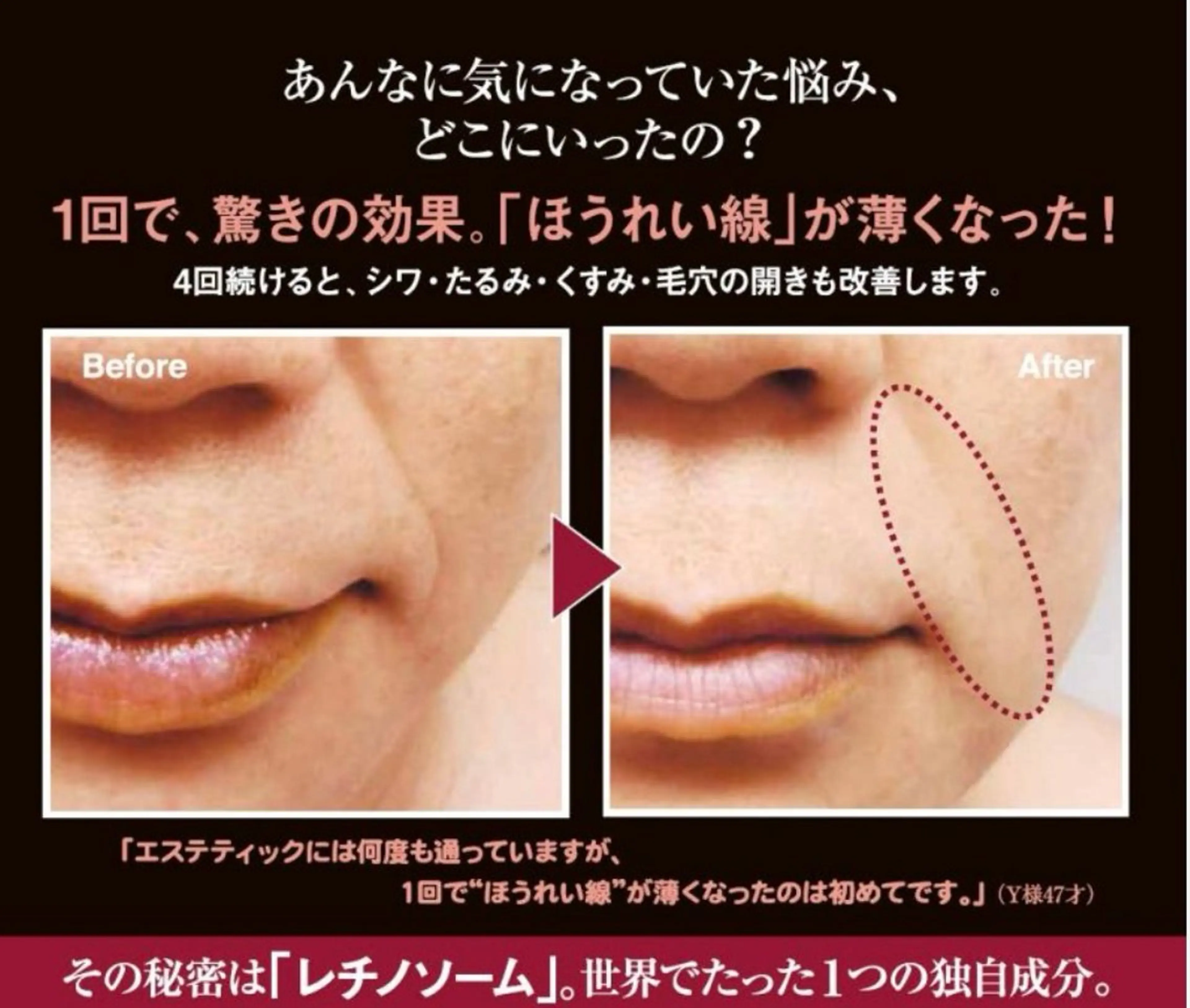 bonuru salonのエステ・リラクイメージ