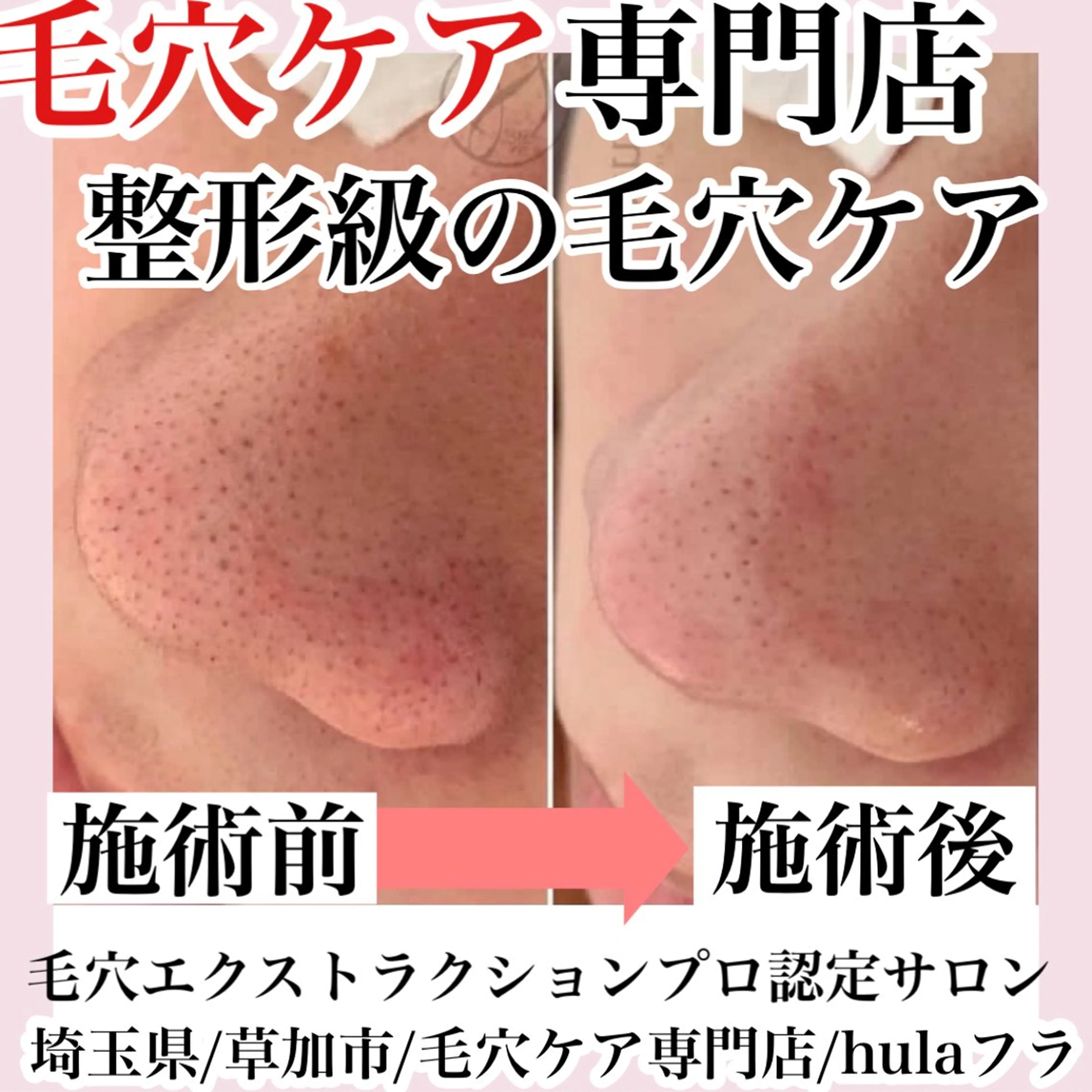 エステ 毛穴専門店hula 杉山智美のエステ・リラクイメージ