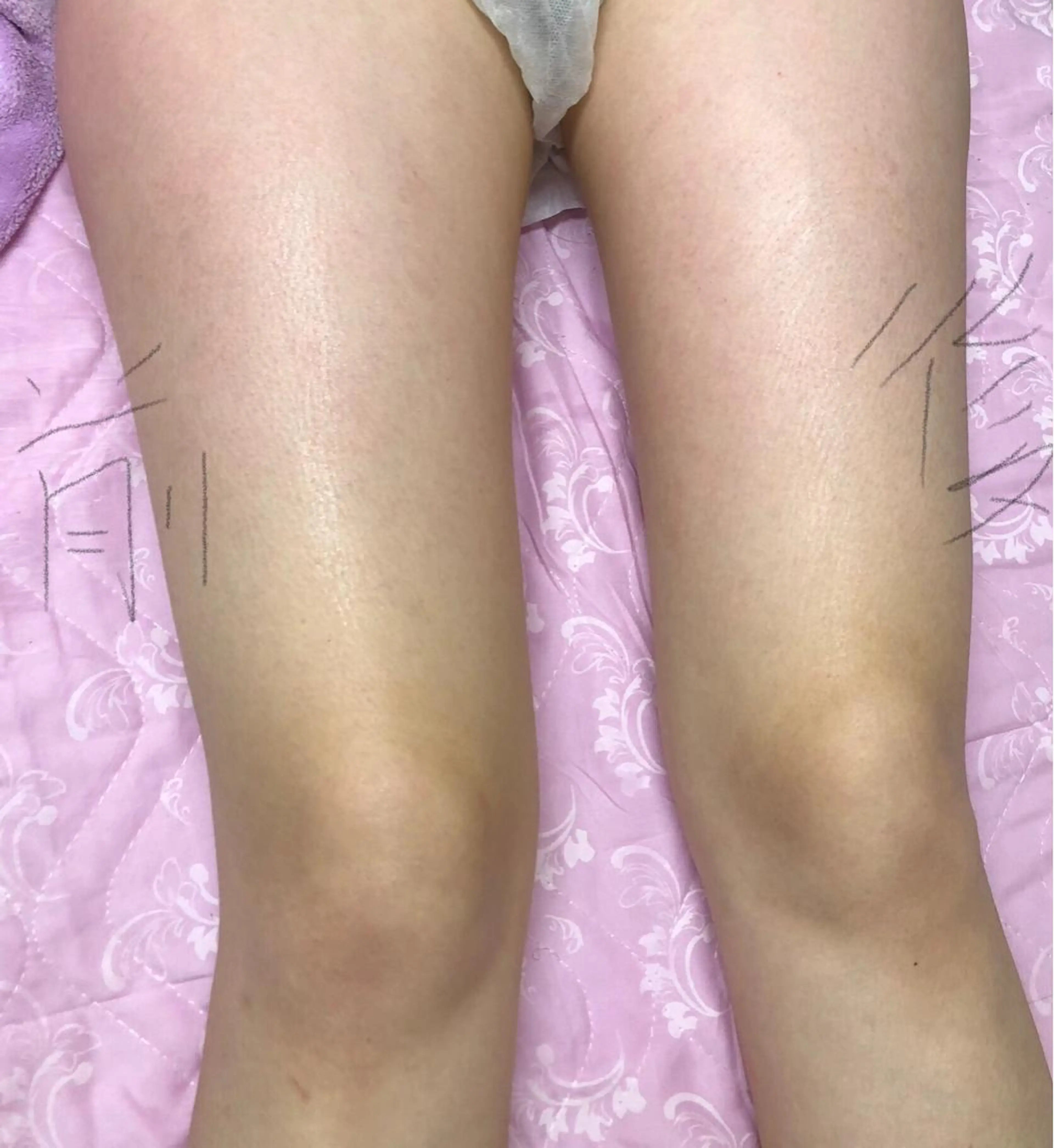 林 萌えのマツエク・マツパデザイン