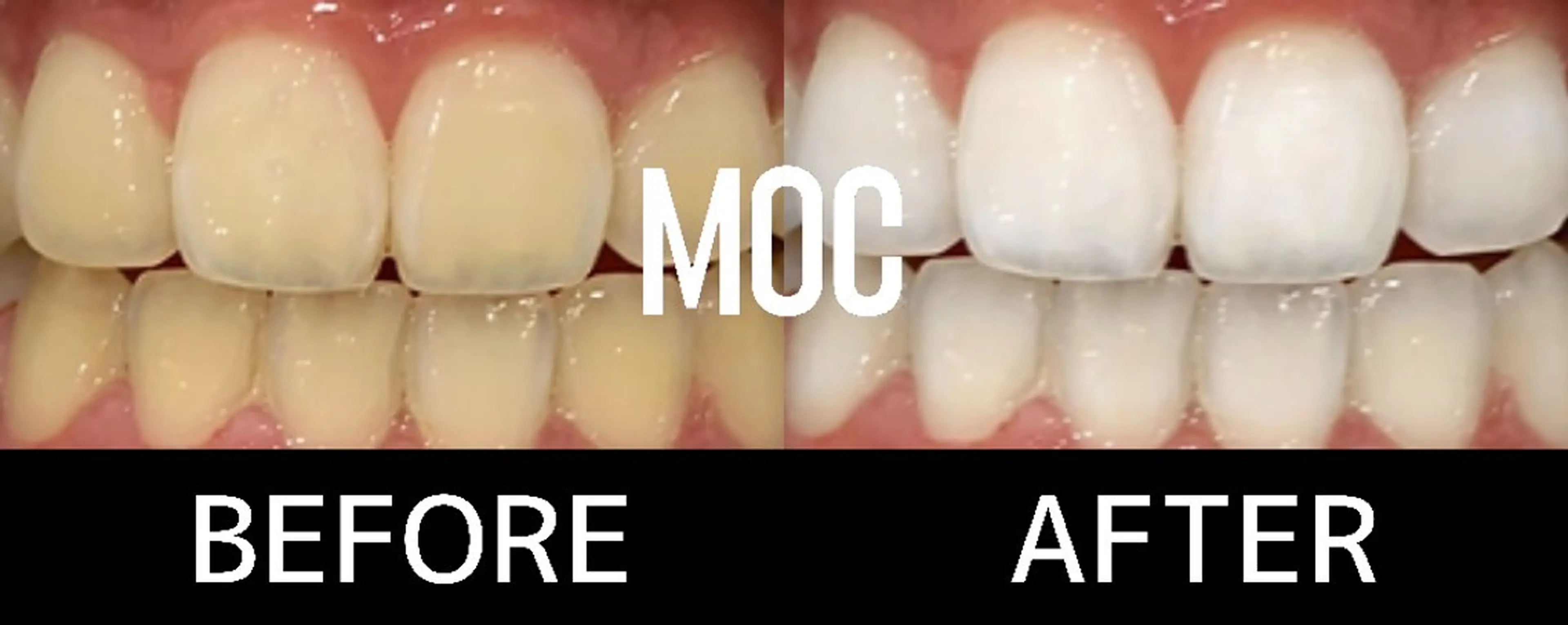 歯科提携セルフダック 宇都宮駒生店のエステ・リラクイメージ