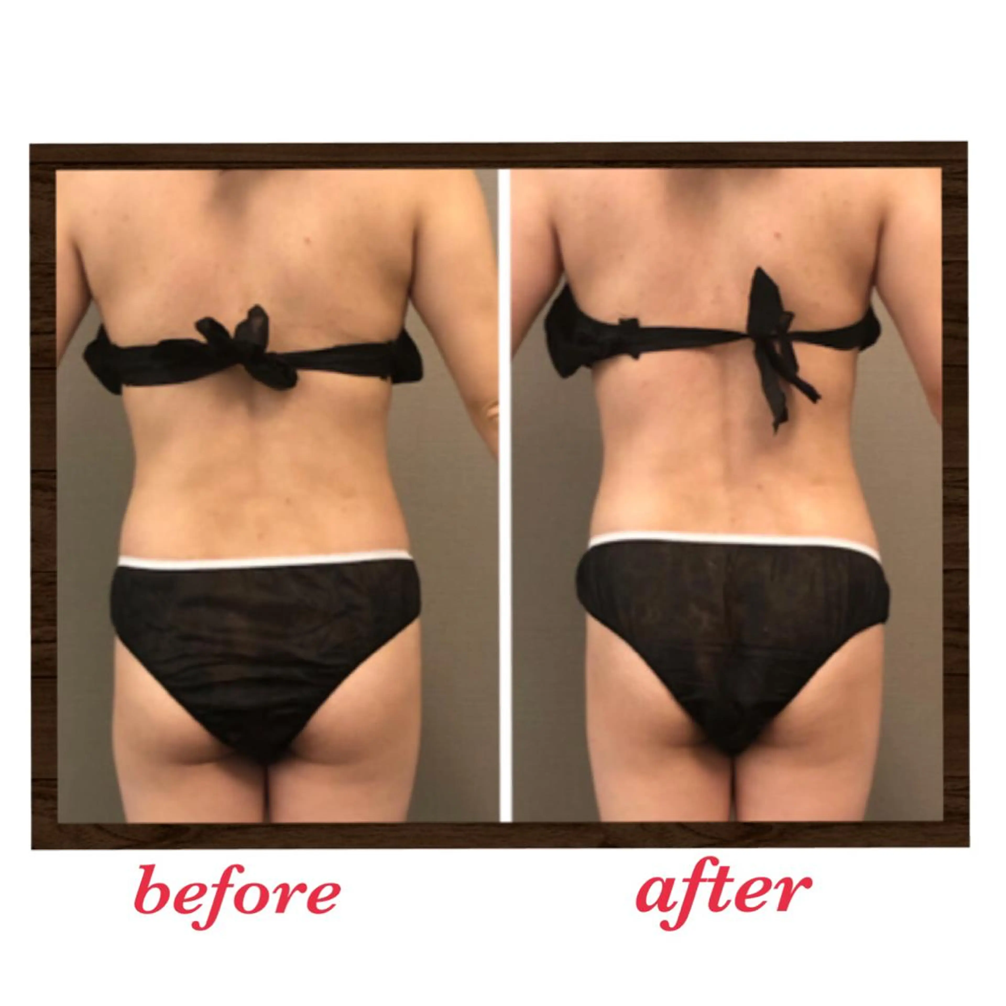 エステ リラク 美ola ビオラのエステ・リラクイメージ