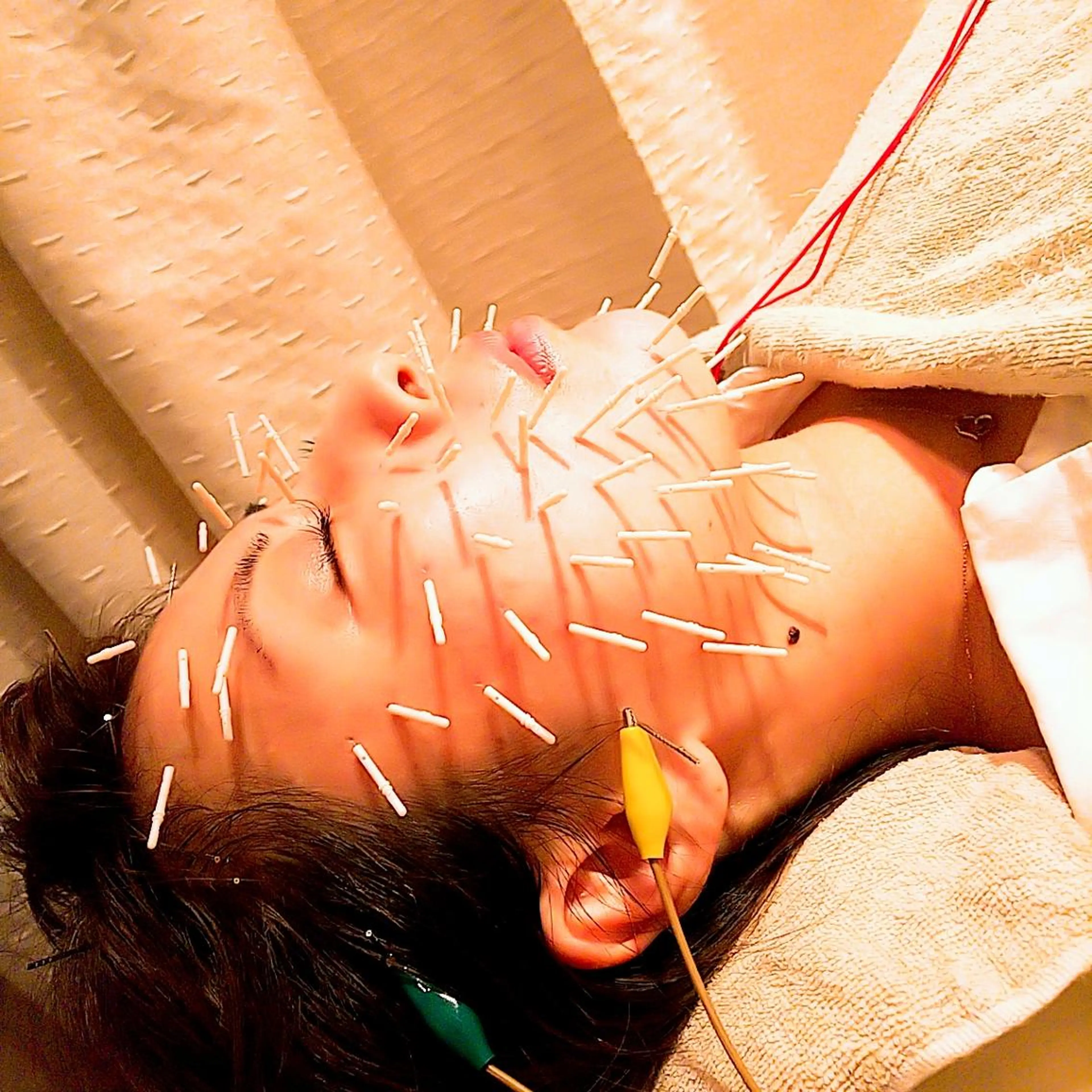 むくみたるみ専門☆ 美容鍼・小顔矯正のエステ・リラクイメージ