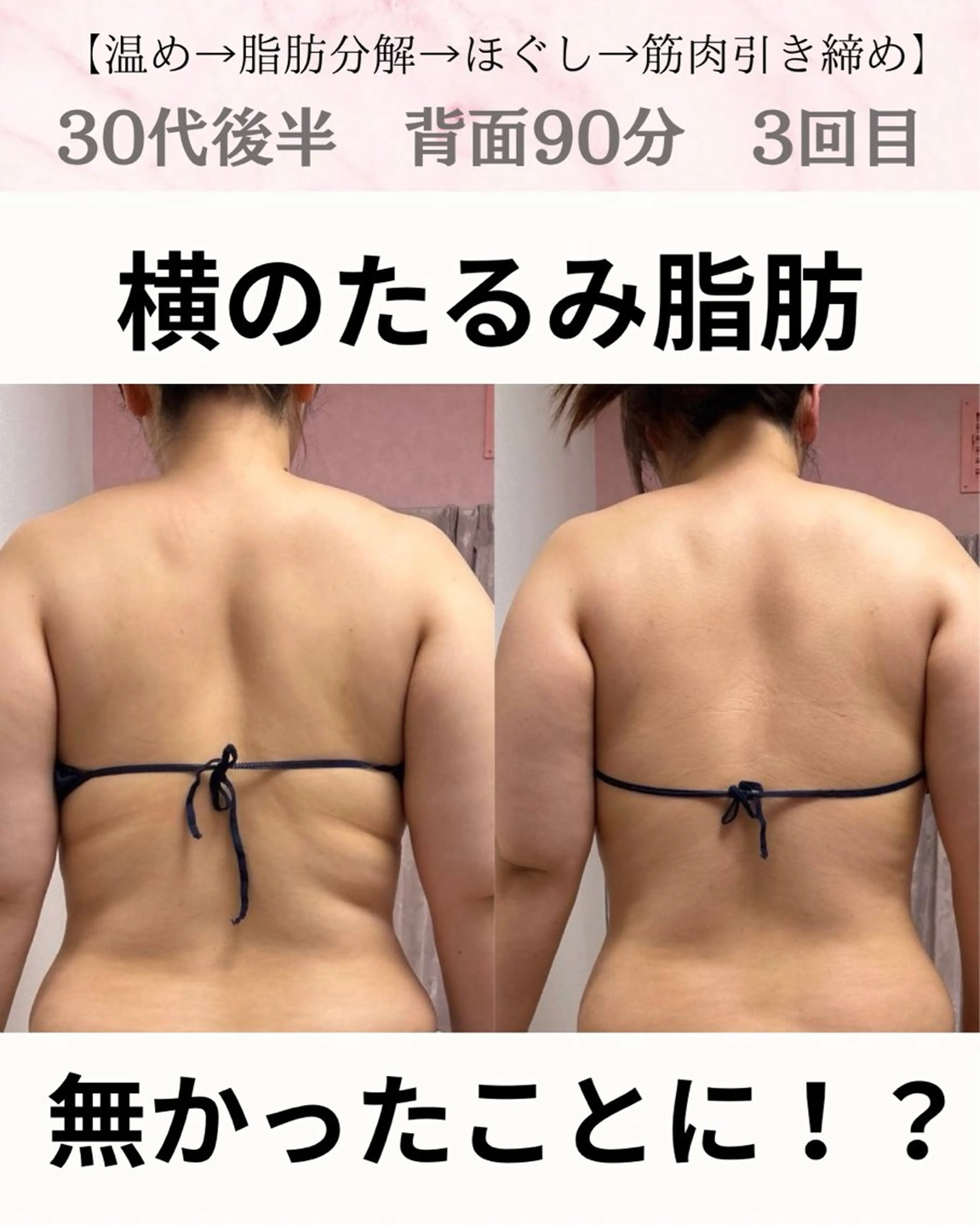 3月限定🌸背中・二の腕集中！上半身たるみ引き締めケア90分¥17,800→12,800の写真