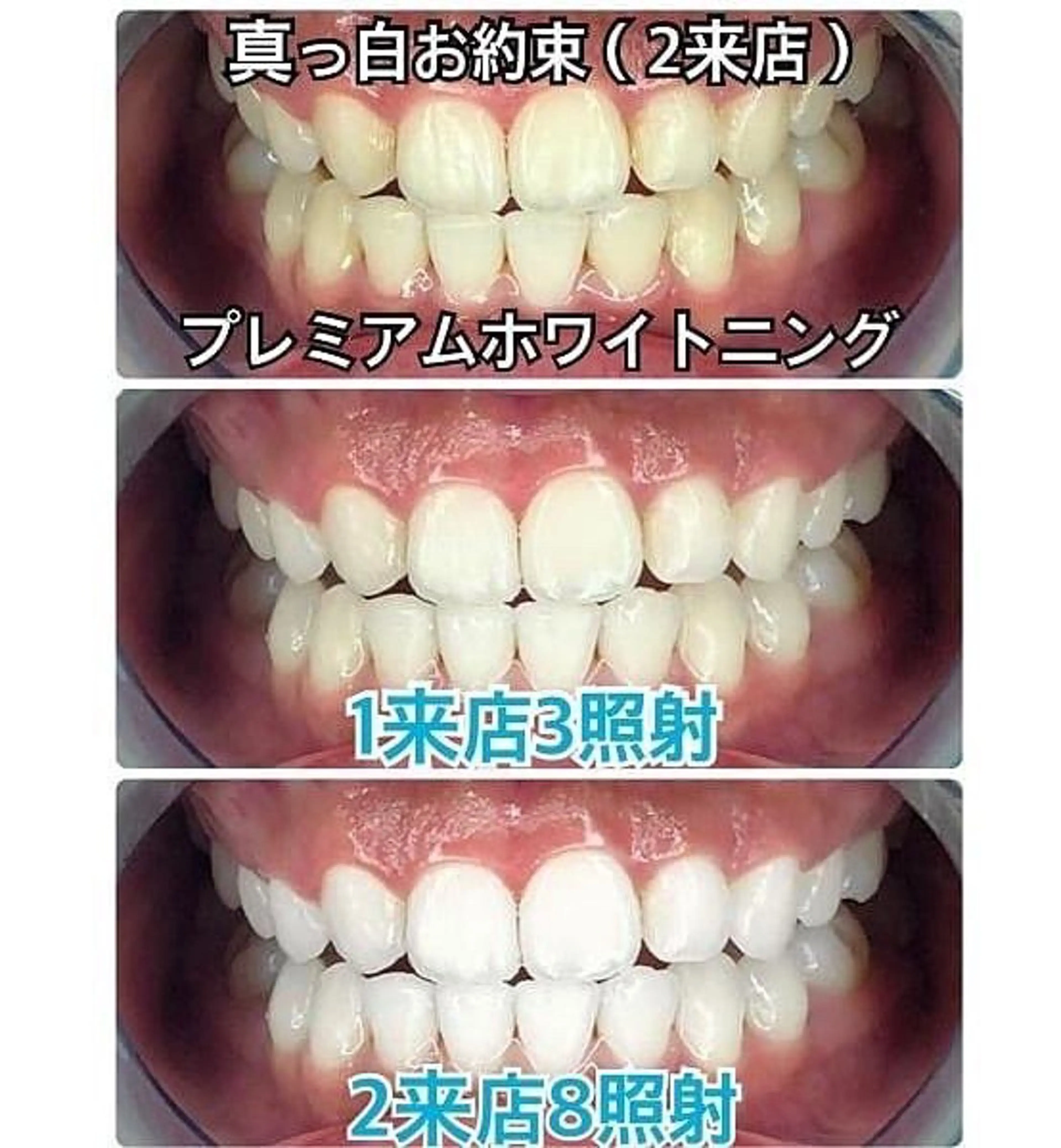 WhiteningBeauty吉祥寺店所属・店舗代表 タクミのその他イメージ