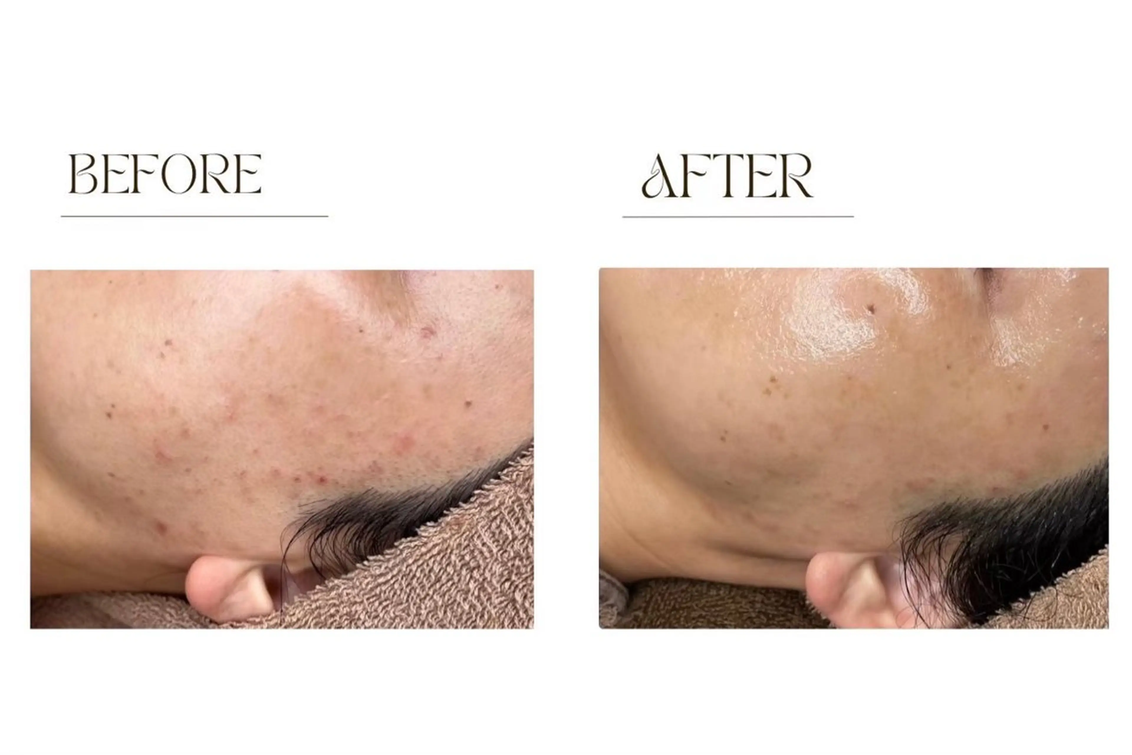 肩こり・むくみ解消専門店　ながれるオイルリンパ Ranun 恵比寿店所属・石黒 美帆のエステ・リラクイメージ