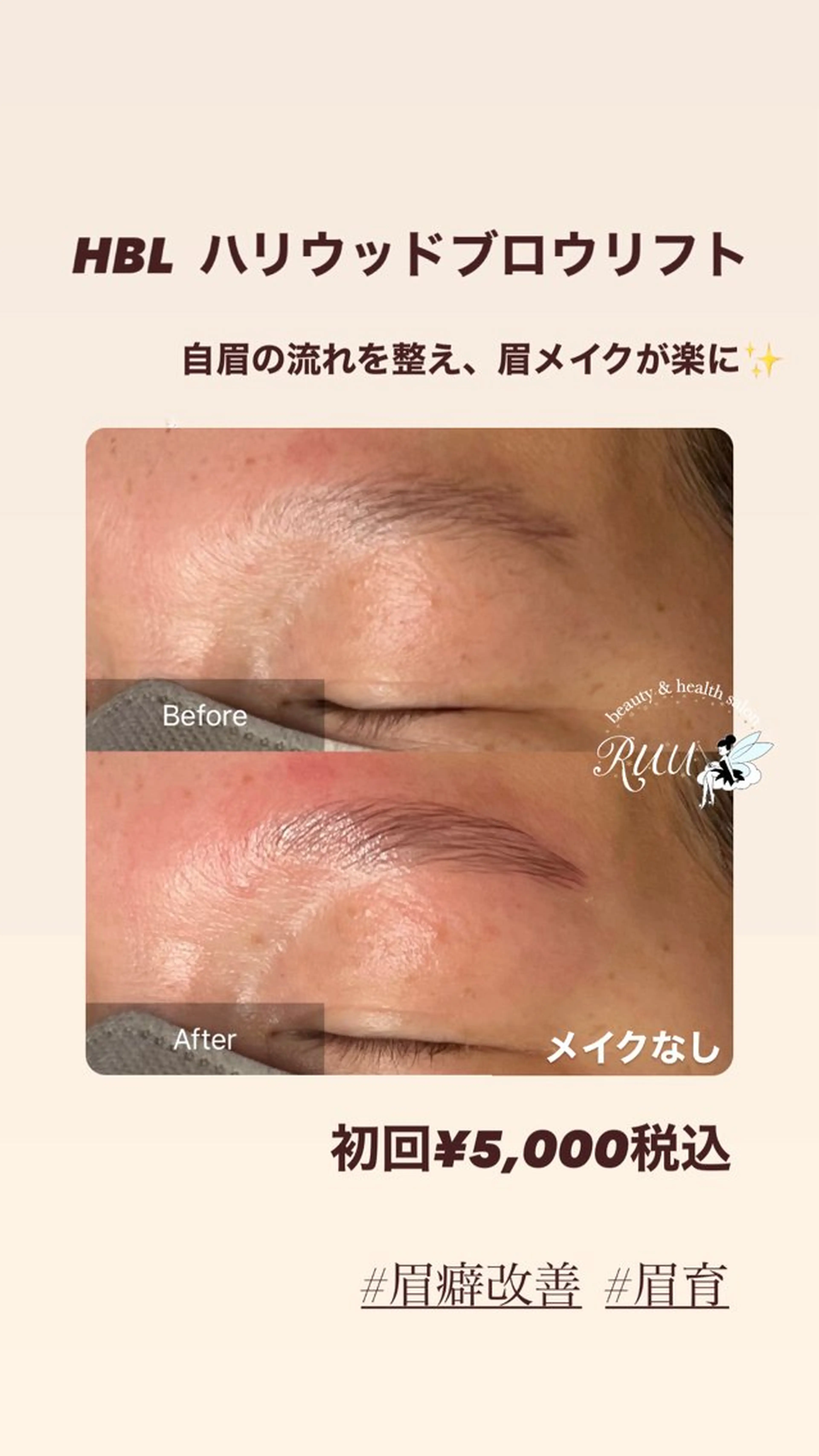 アイブロウ ハリウッドブロウリフト 【頭痛、睡眠改善】 salon RUUのエステ・リラクイメージ