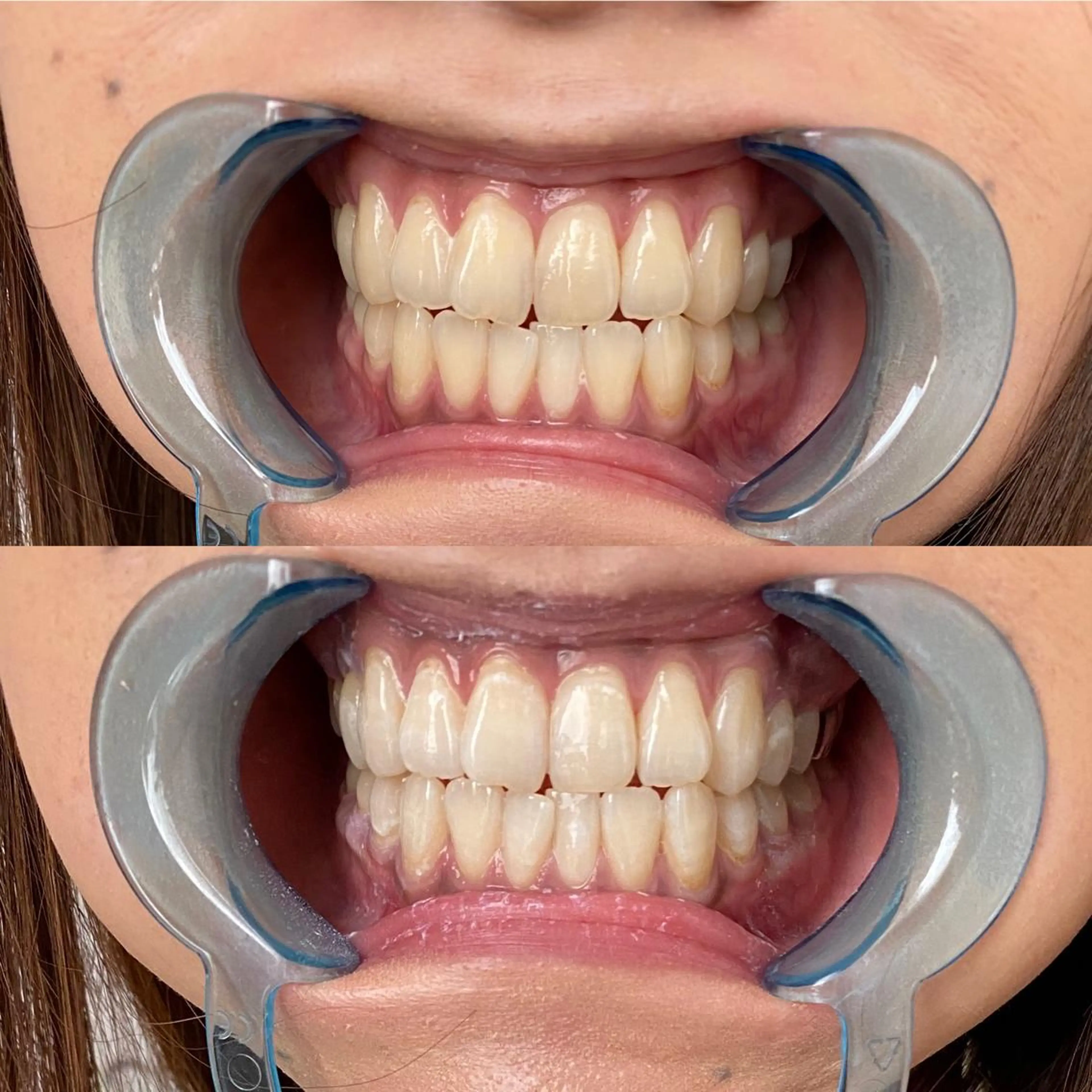 R E O T I A R A（レオティアラ）所属・高屋 昌子のその他イメージ