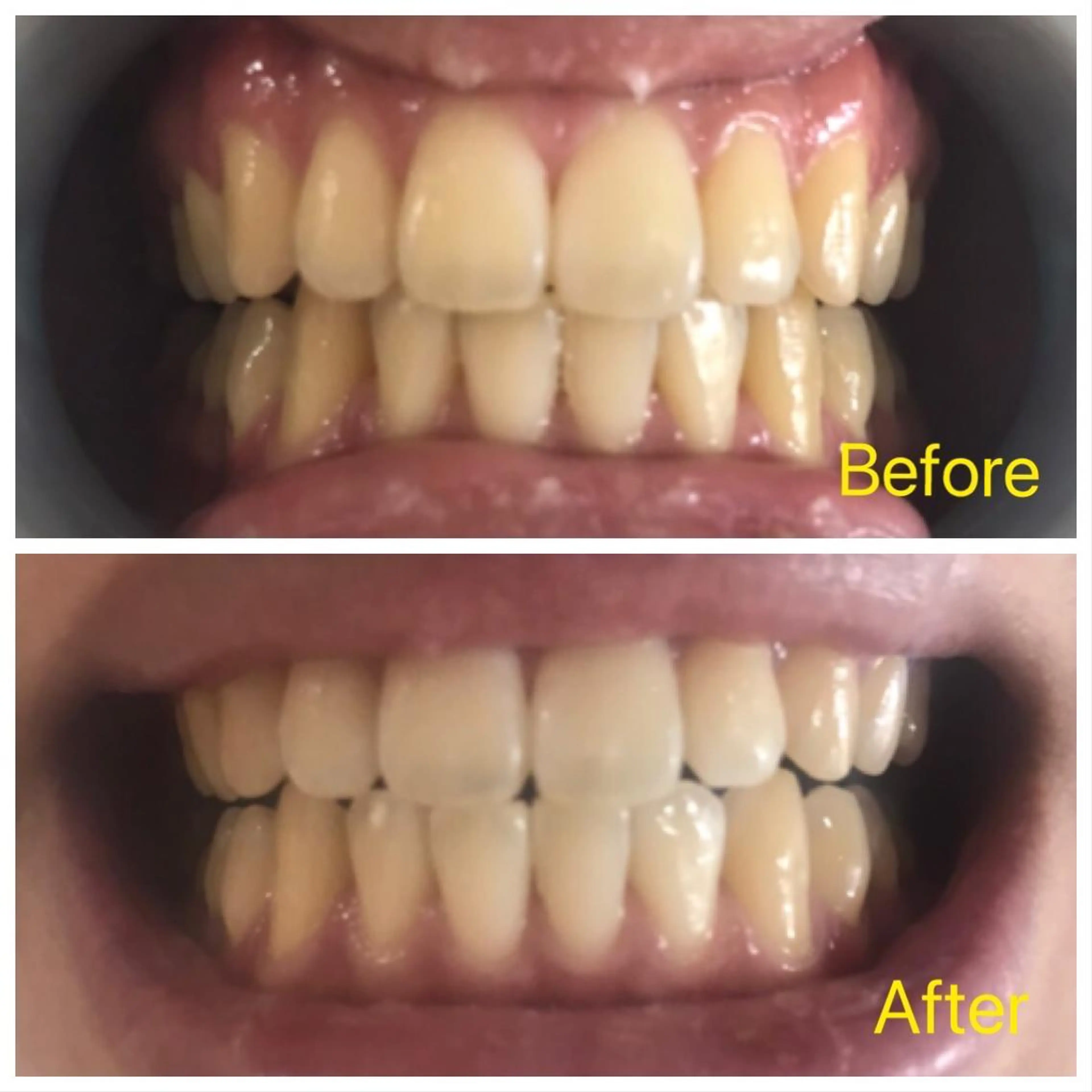 M渋谷店所属・M渋谷 ホワイトニングのエステ・リラクイメージ