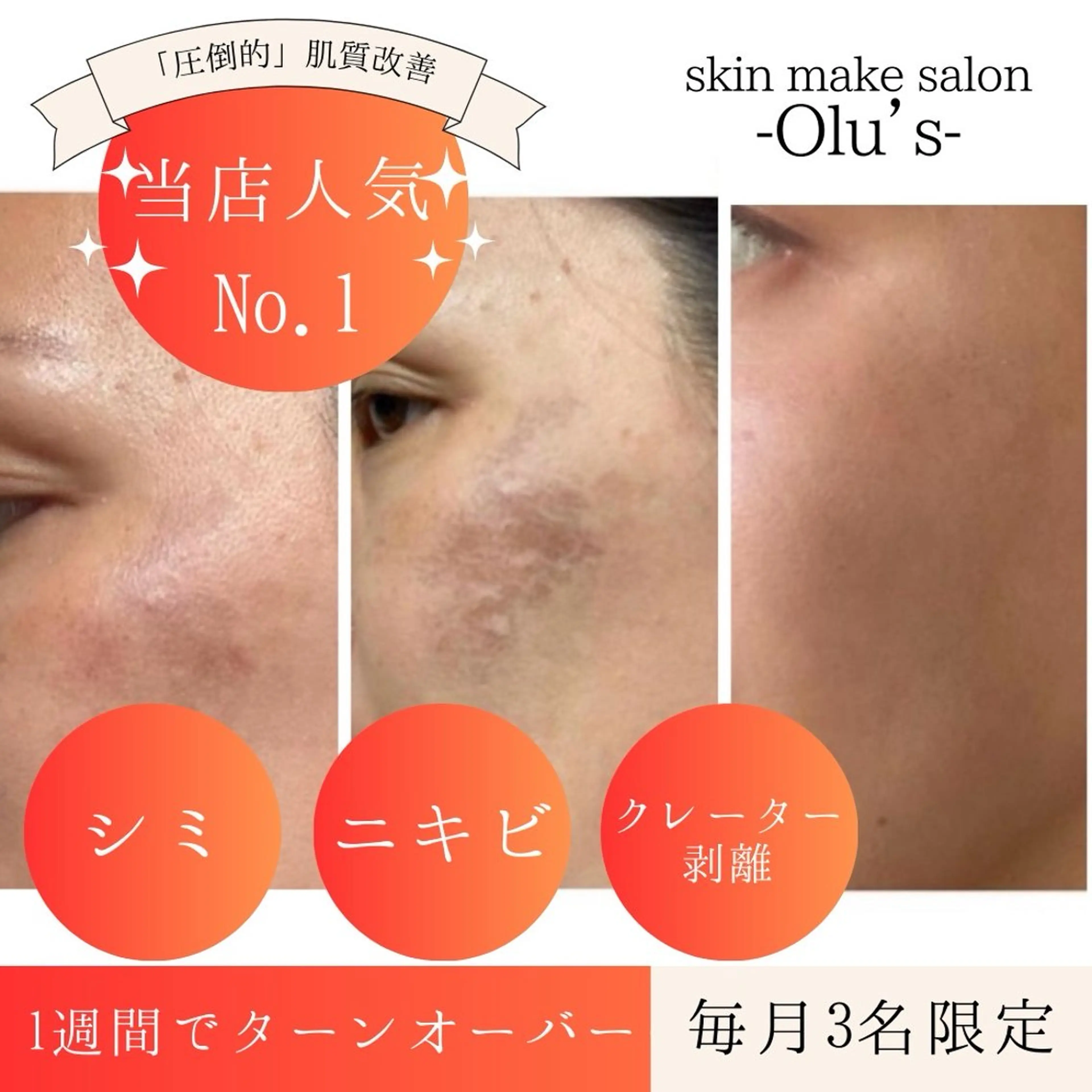 エステ skin make salon -Olu's-所属・毛穴・肌質改善サロン ✨Tomaのその他イメージ
