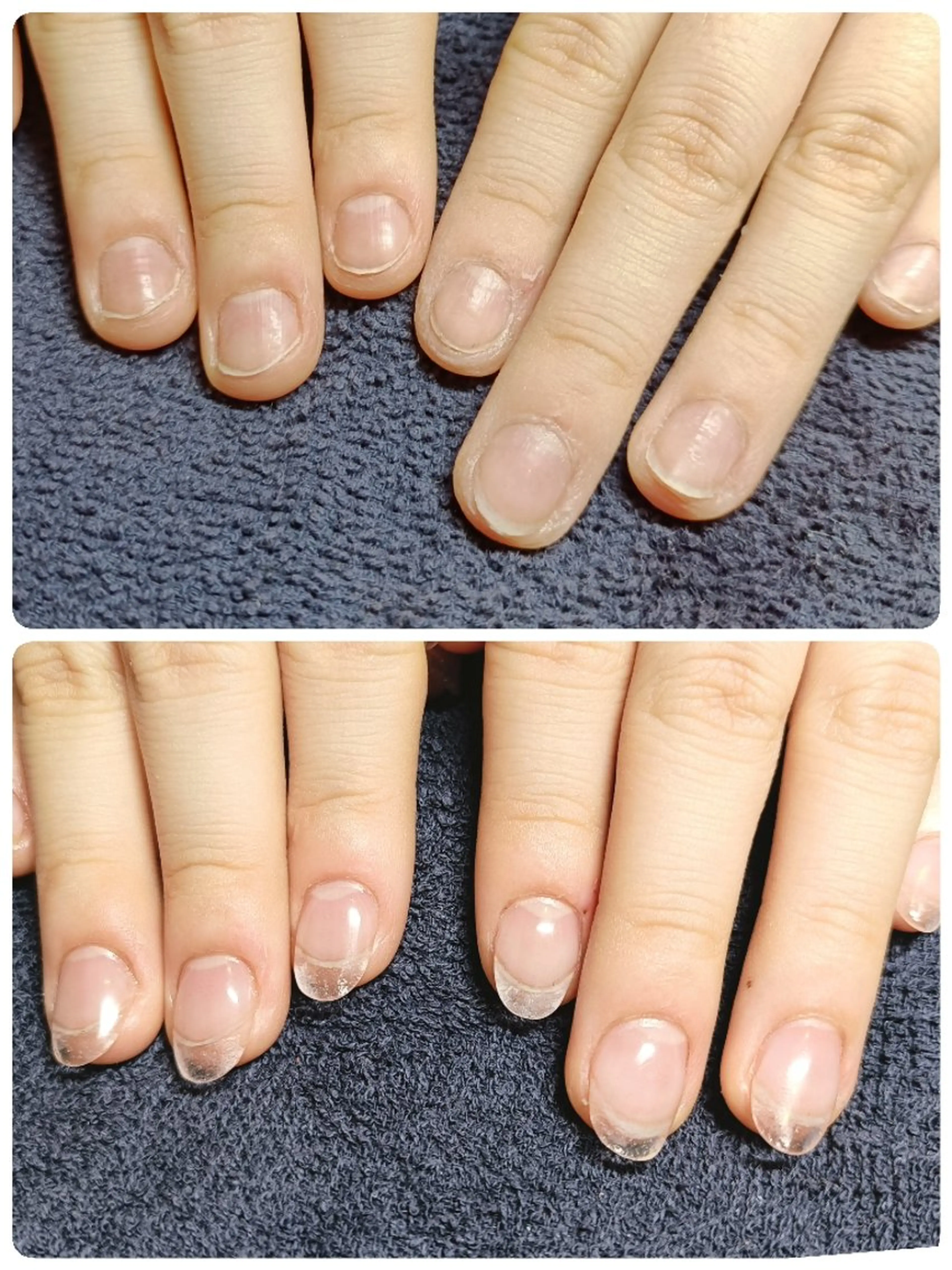 ネイル クリアネイル 長さ出し ハンドネイル ハンドケア 深爪矯正/爪育成ケア manie nailのネイルデザイン