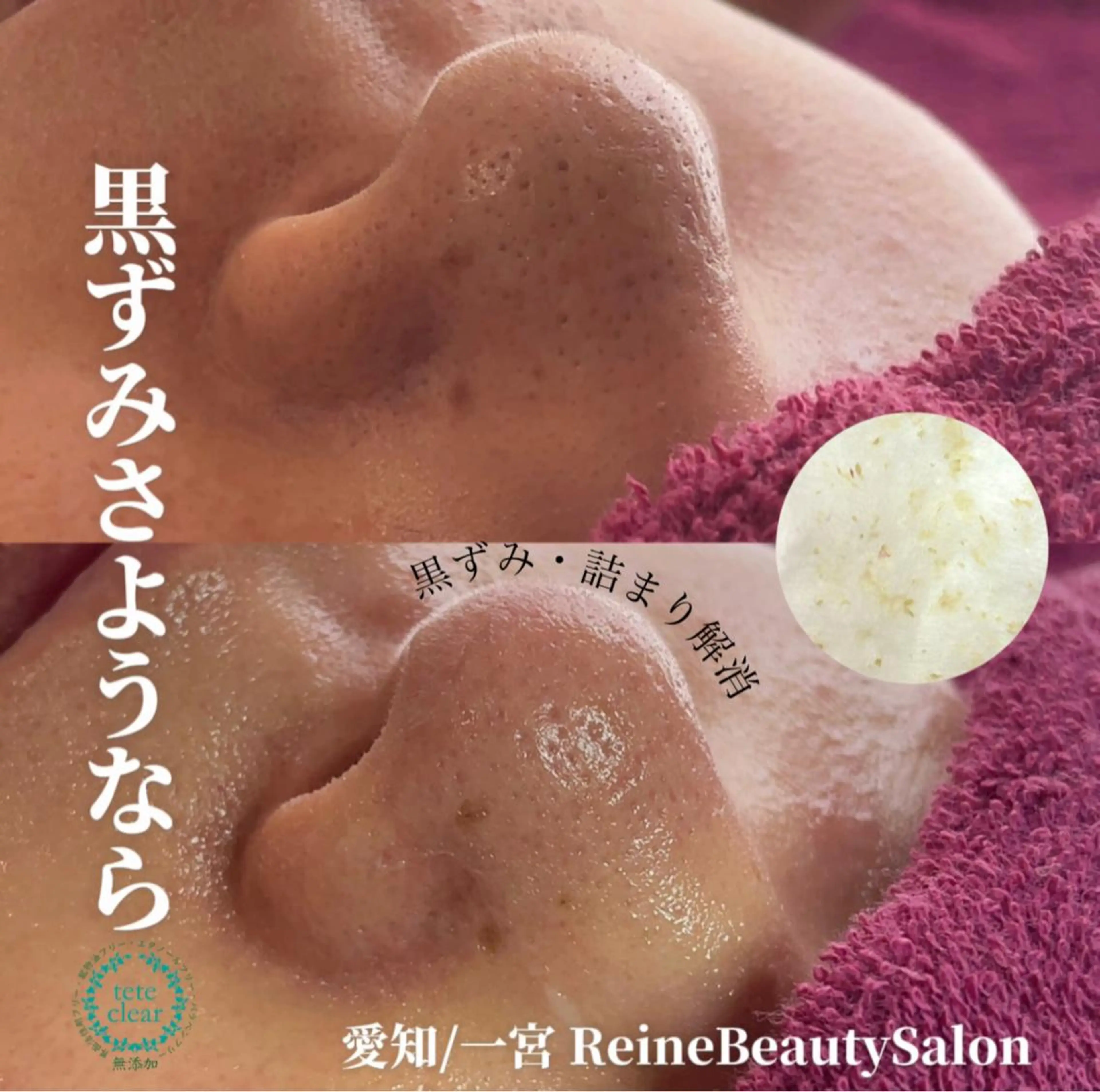 エステ Reine BeautySalon所属・毛穴/シミ肝斑/脱毛 横山梨里のエステ・リラクイメージ