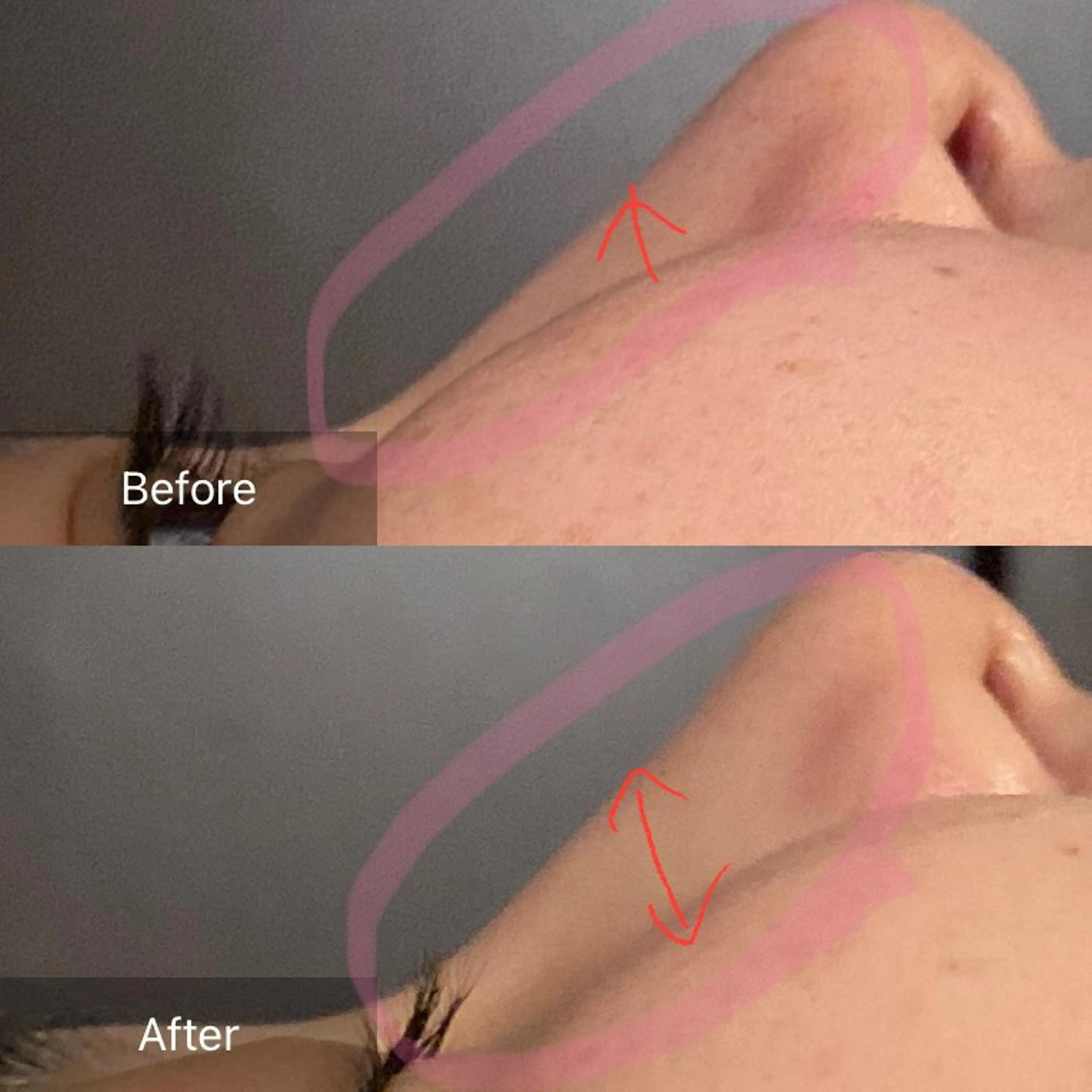 Mandarin Orange所属・毛穴から始める肌メン テマンダリンオレンジのエステ・リラクイメージ