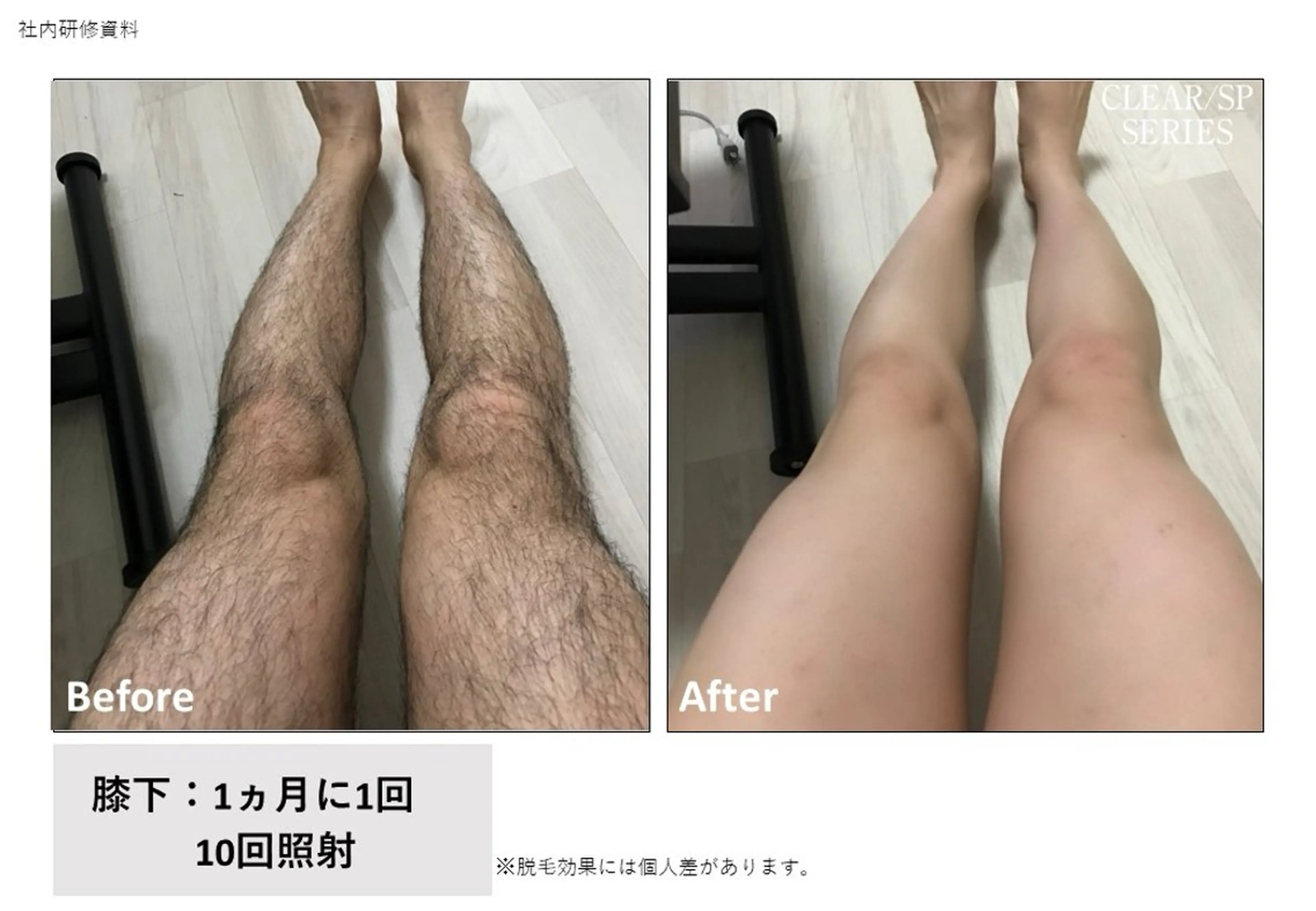 メンズ 脱毛 トータルビューティー サロン　Lisseの眉毛・アイブロウイメージ