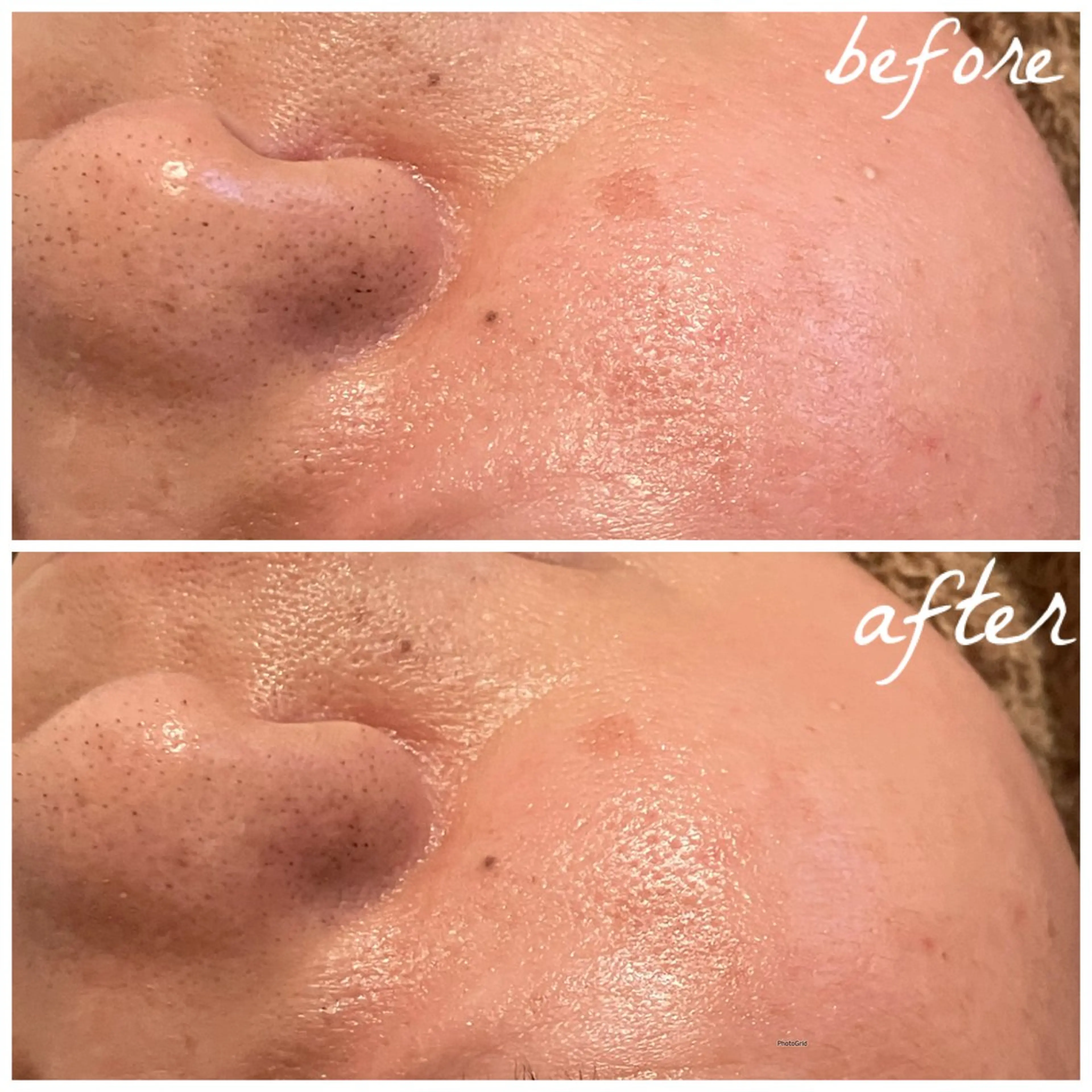 メンズ エステ メナード岐阜茜部 杉浦のエステ・リラクイメージ