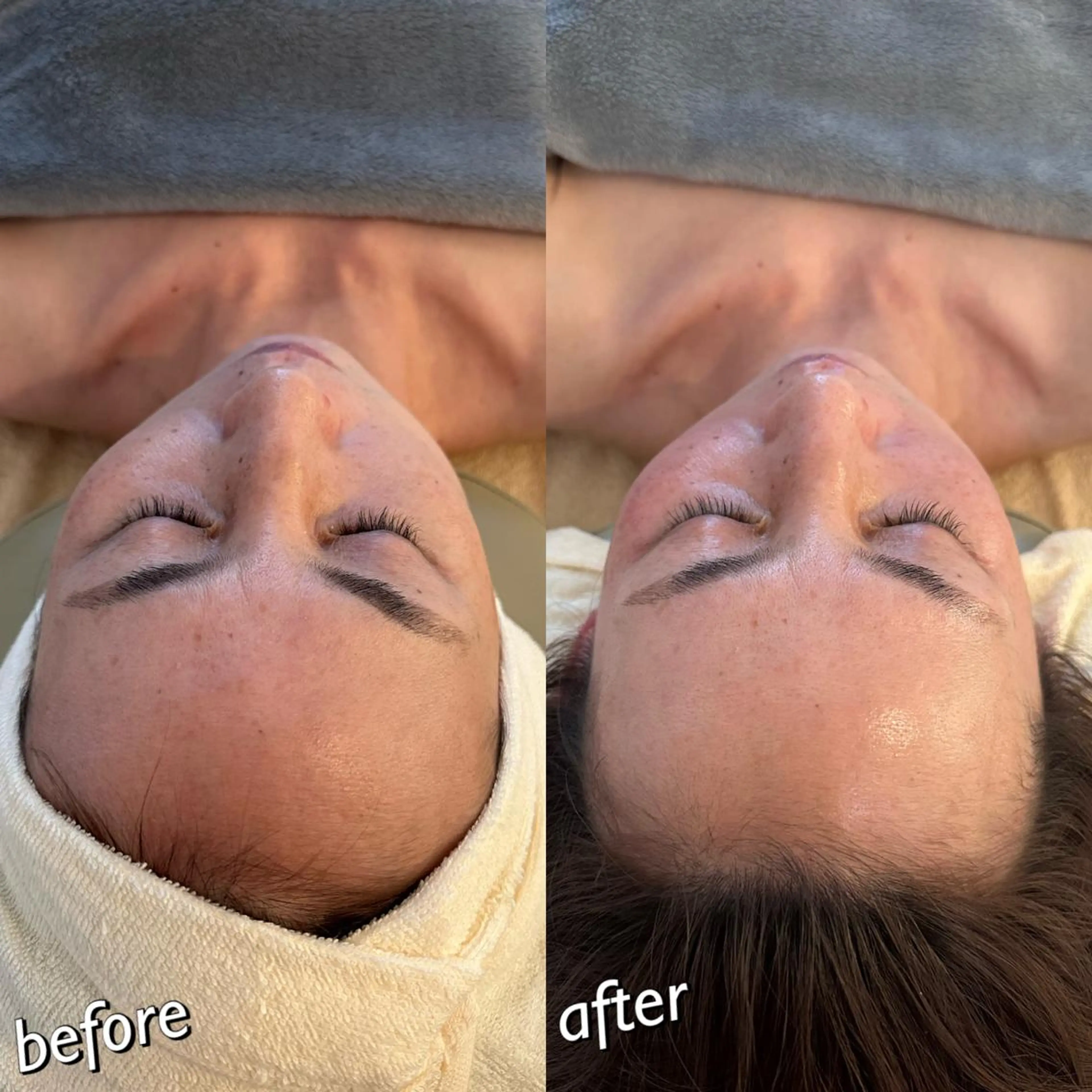 うなじ脱毛/美肌脱毛 LABELのエステ・リラクイメージ