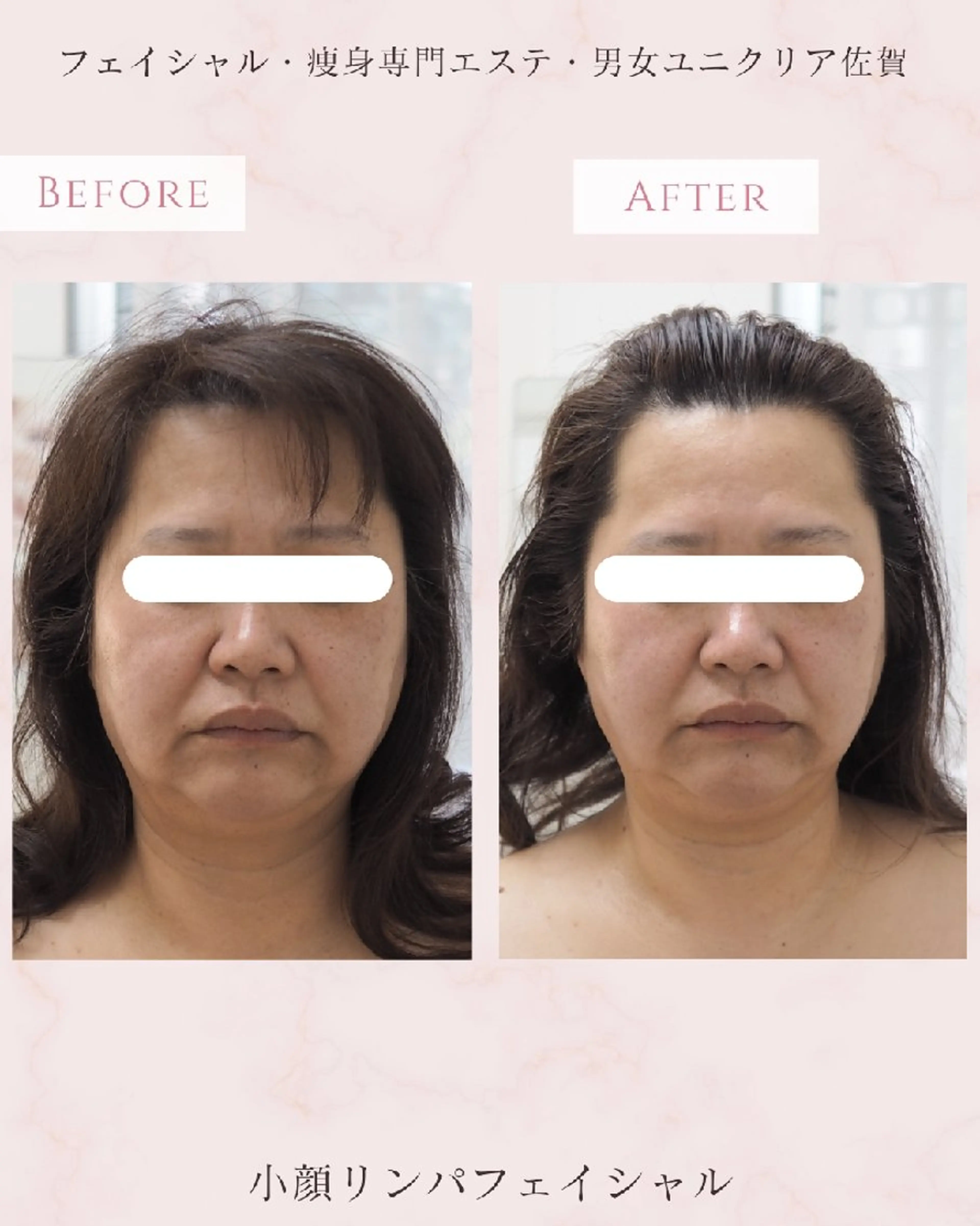 エステ ユニセックスエステサロンUniclear所属・痩身&フェイシャル Uniclearのエステ・リラクイメージ