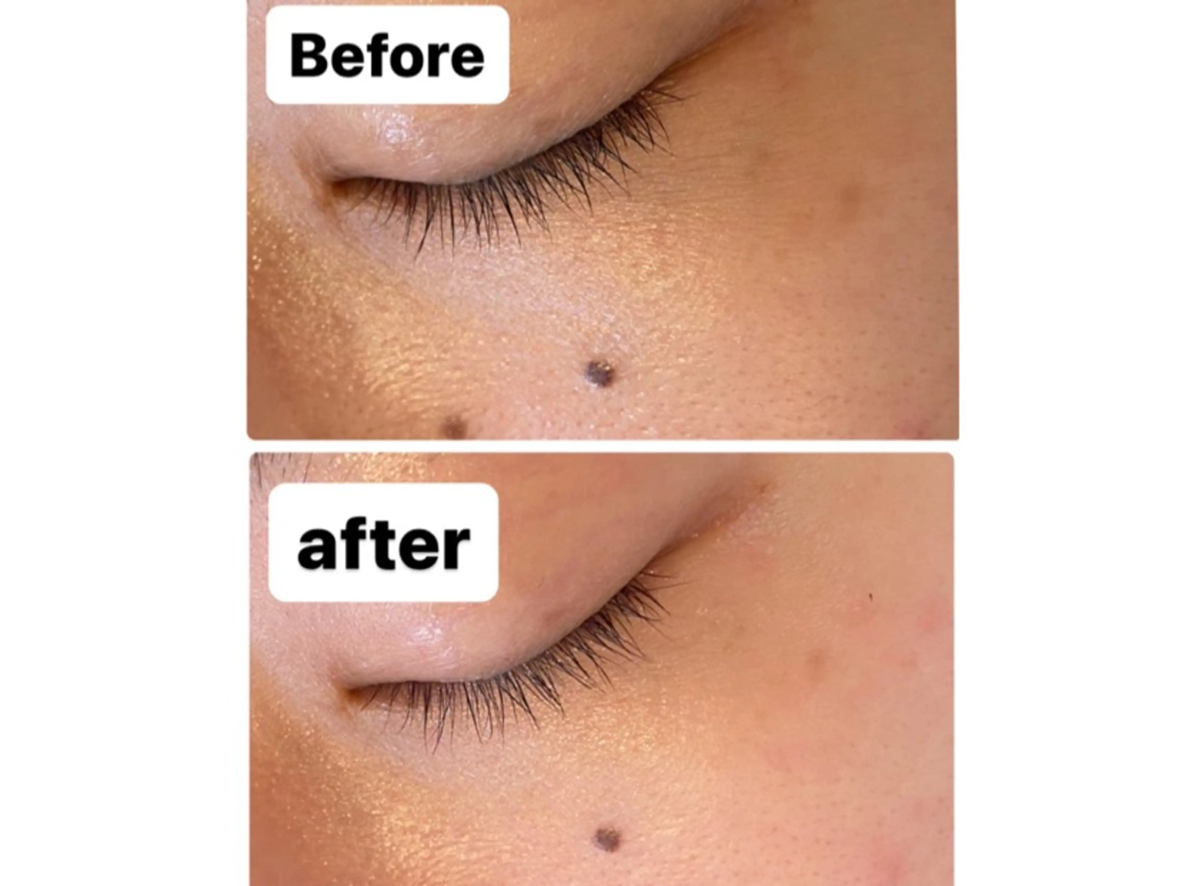 脱毛・エステサロン LuLuNのエステ・リラクイメージ