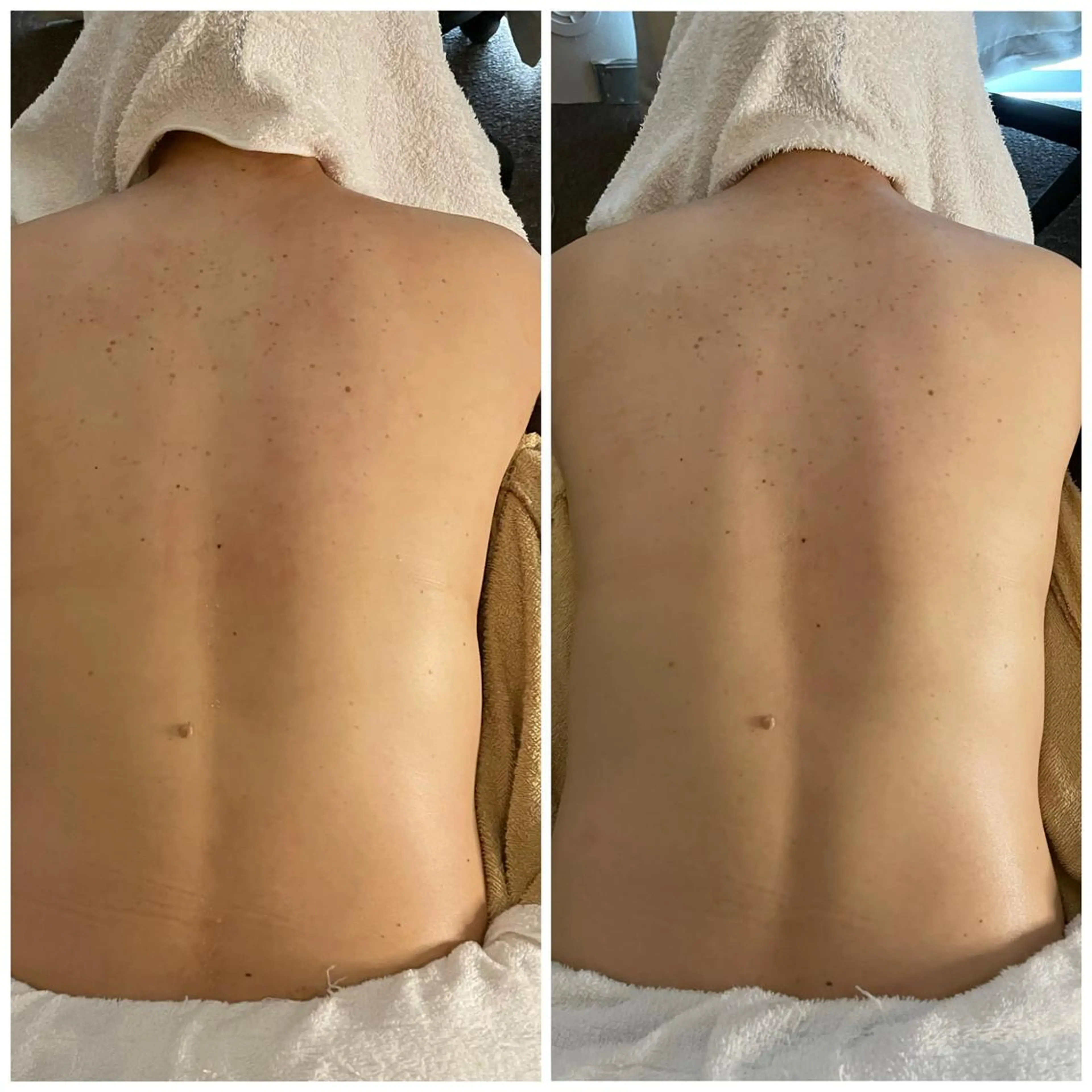 エステ リラク 小顔毛穴✨✨ POLA弥富駅前店のエステ・リラクイメージ