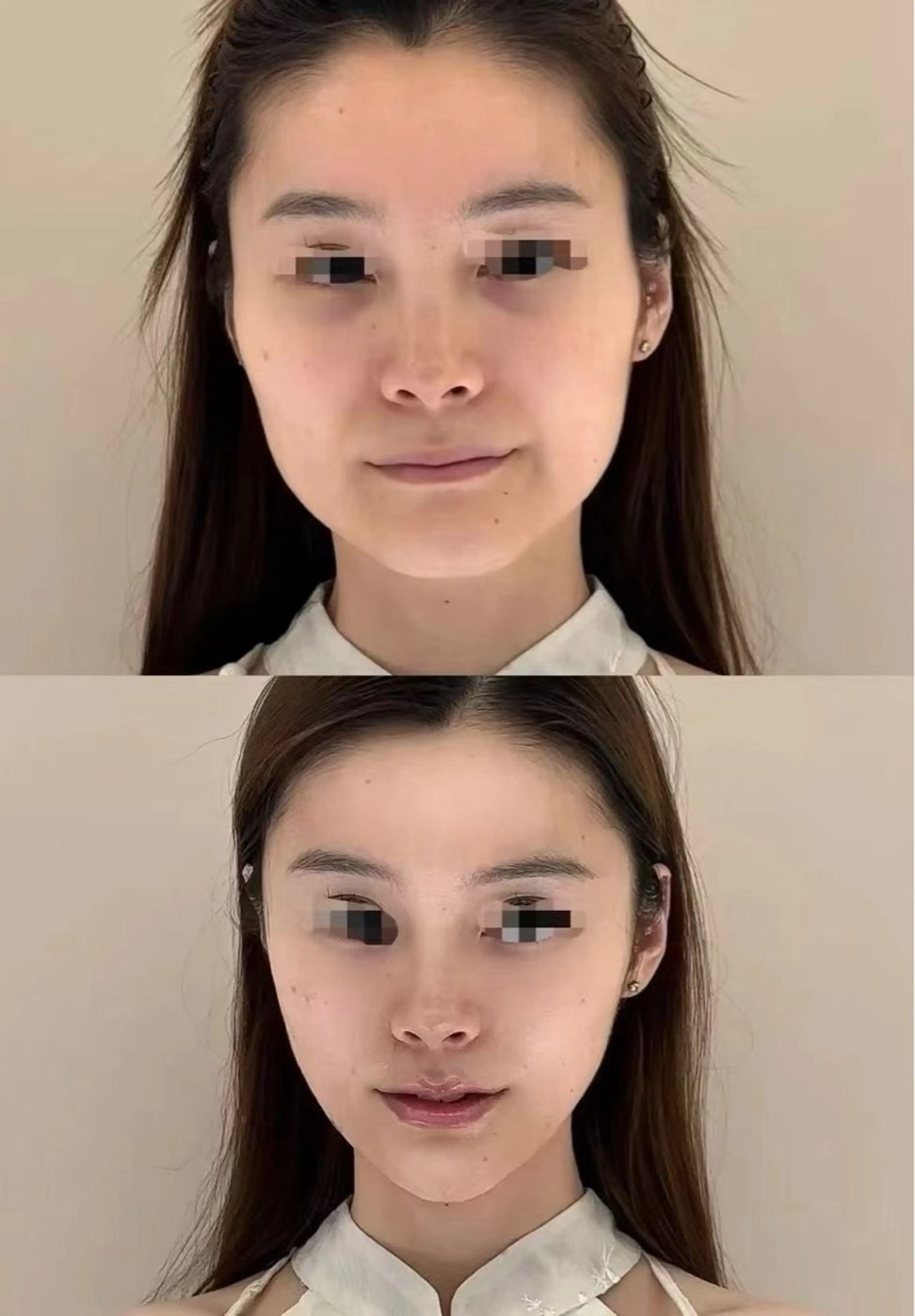 パーマ エステ aliaハイフ&水光ジェットサロン所属・aliaハーブ水光店 エステティシャン募集のエステ・リラクイメージ