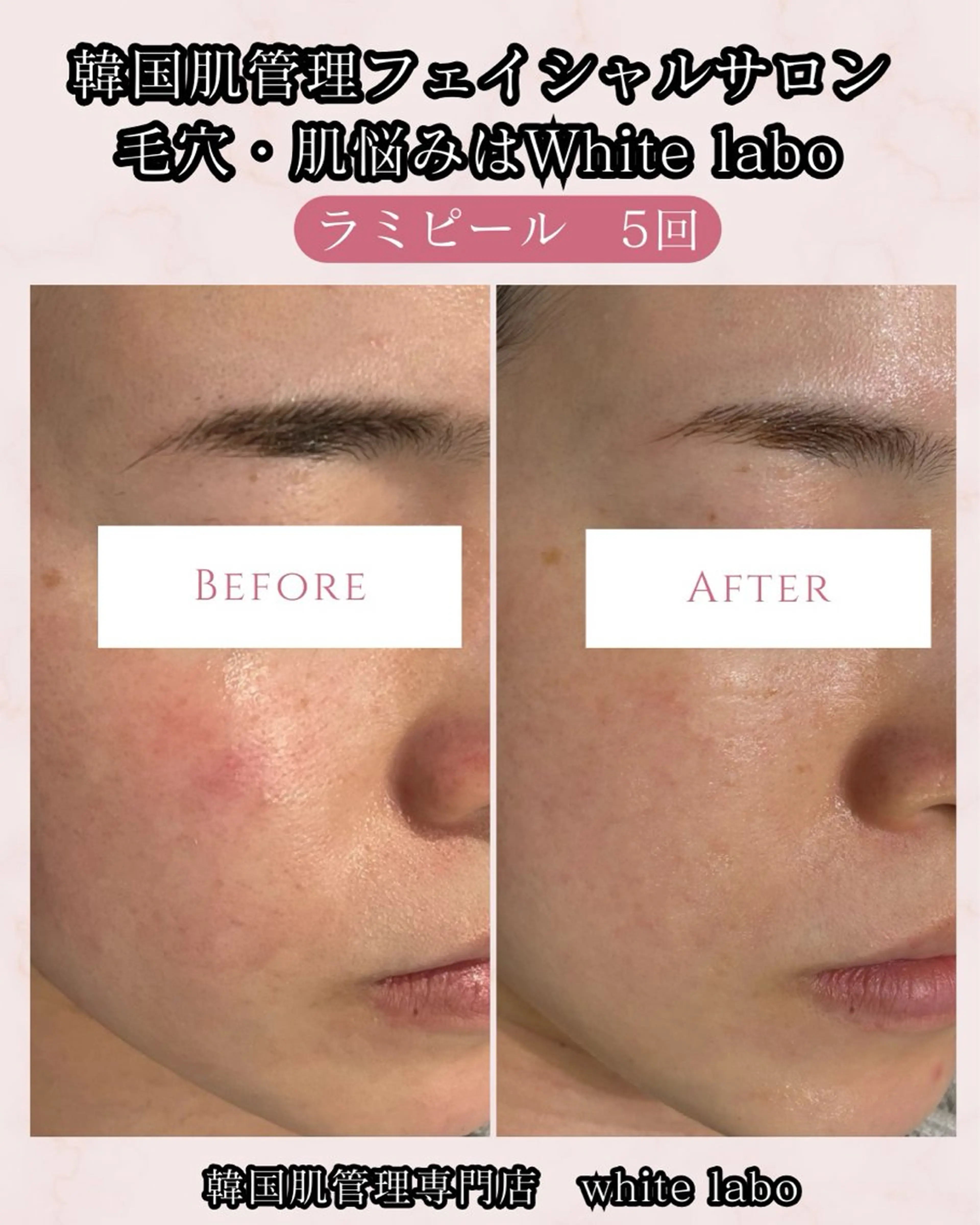 韓国肌管理専門店　White labo 梅田店所属・ホワイトラボ梅田 ｜毛穴・韓国肌管理のエステ・リラクイメージ