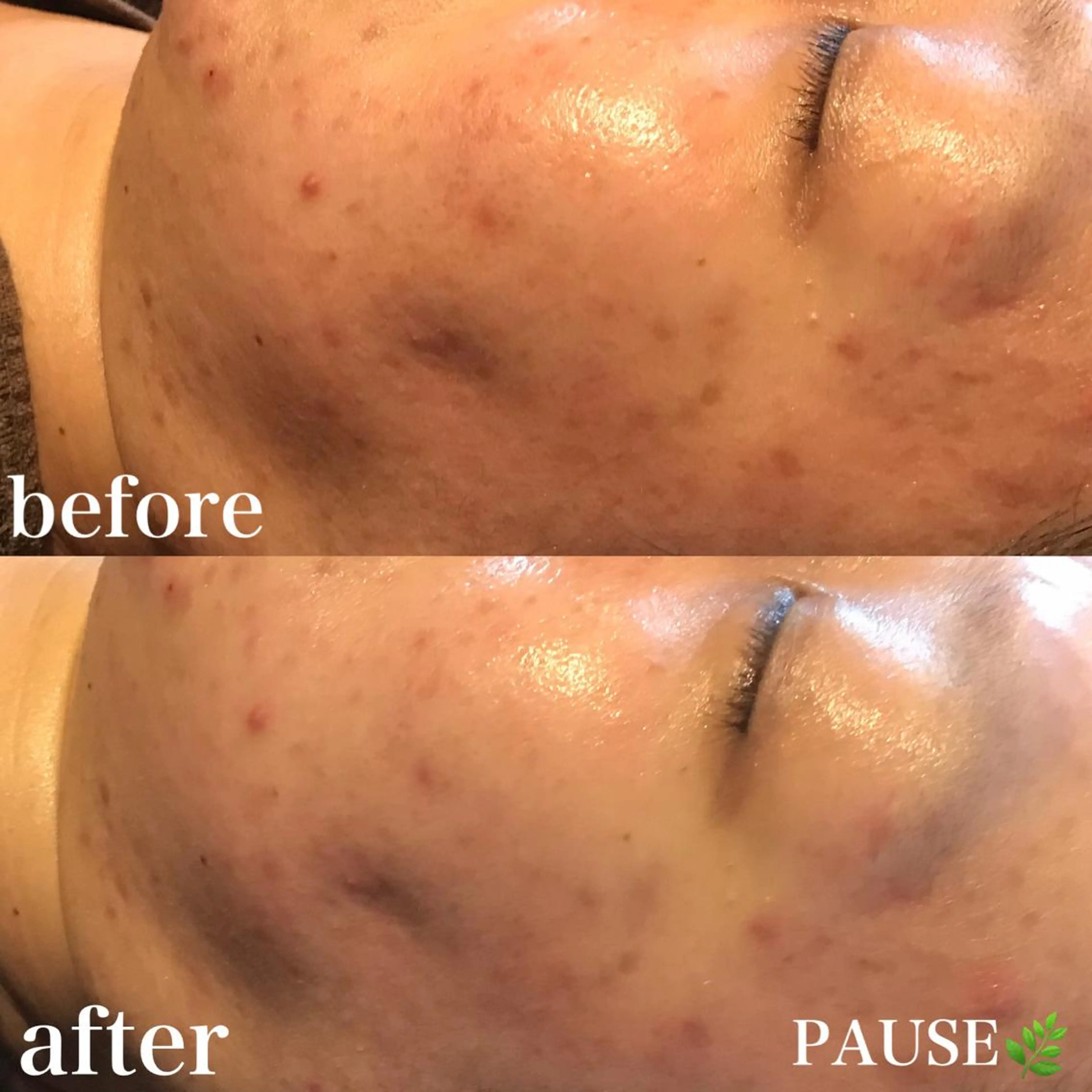 エステ 浜野 恵美のエステ・リラクイメージ