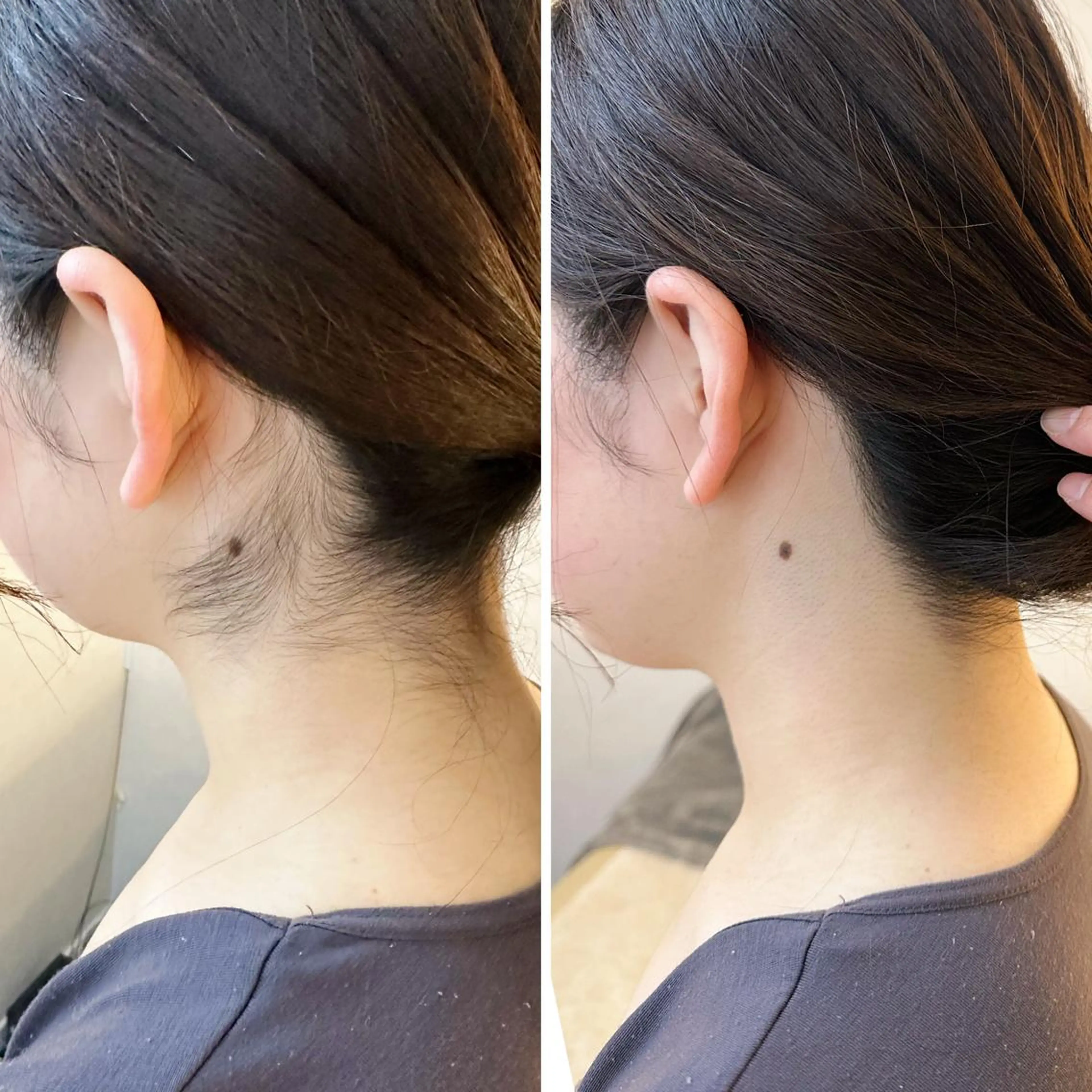 うなじ脱毛/美肌脱毛 LABELのエステ・リラクイメージ