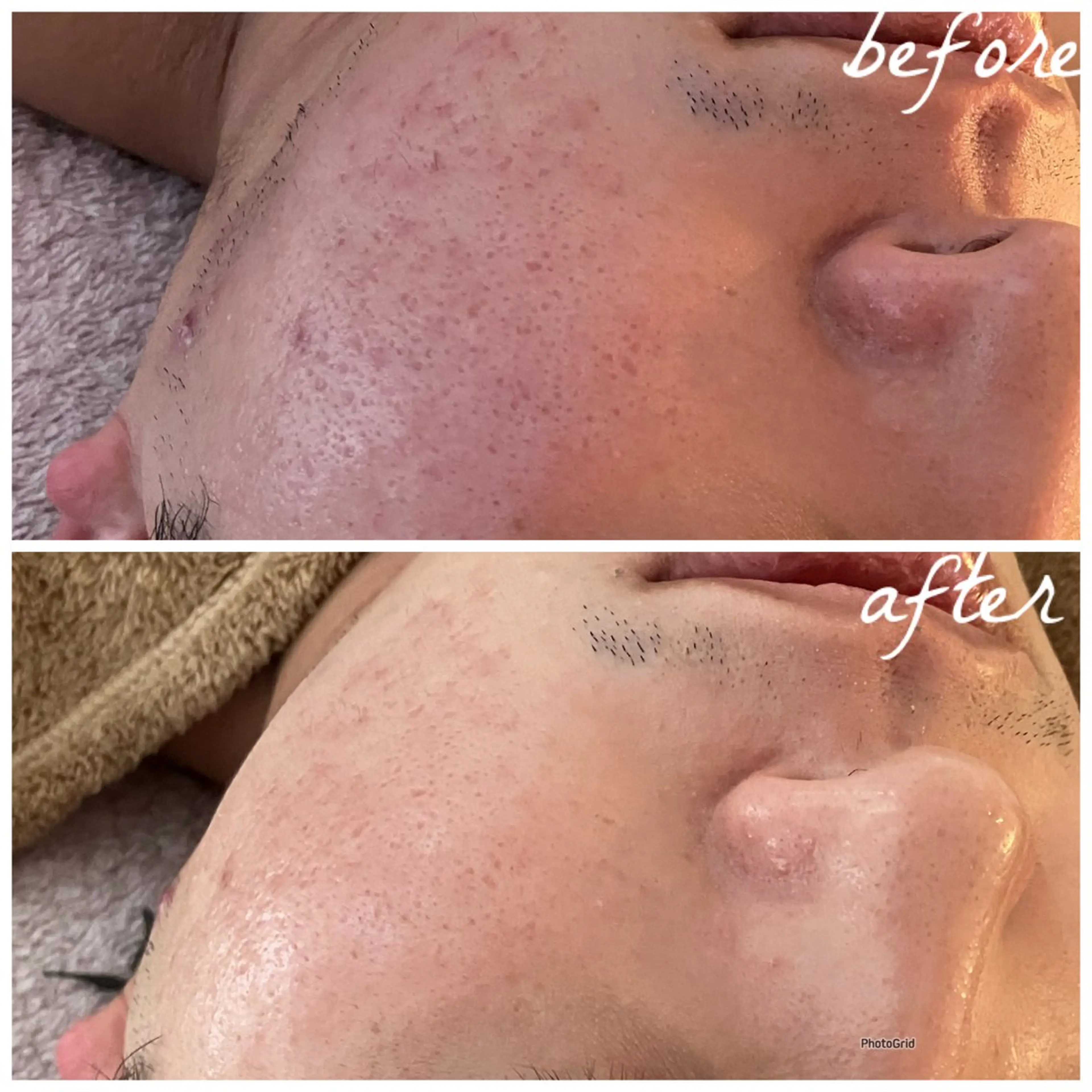 メンズ メナード岐阜茜部 杉浦のエステ・リラクイメージ