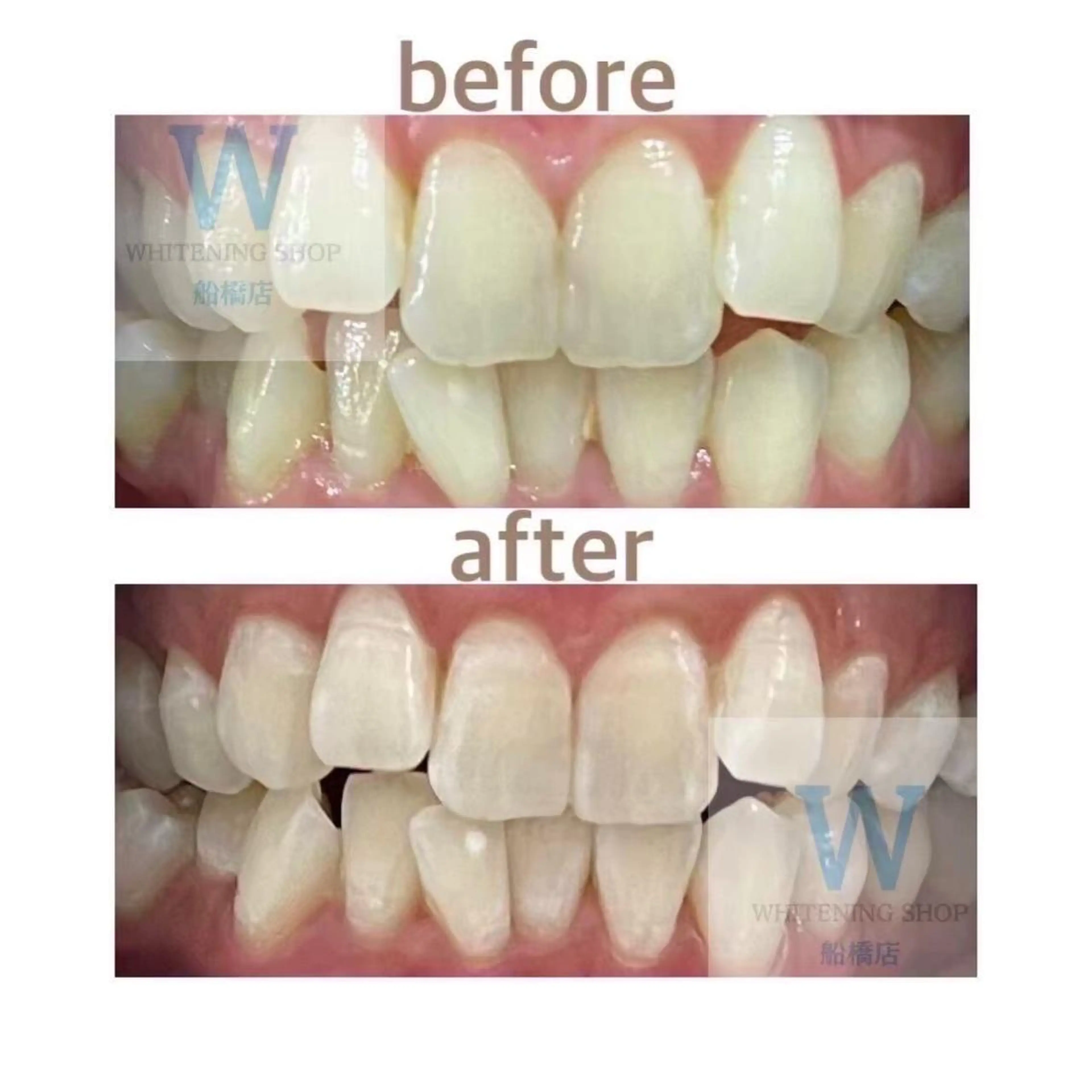 ホワイトニング ショップ船橋店🦷のエステ・リラクイメージ