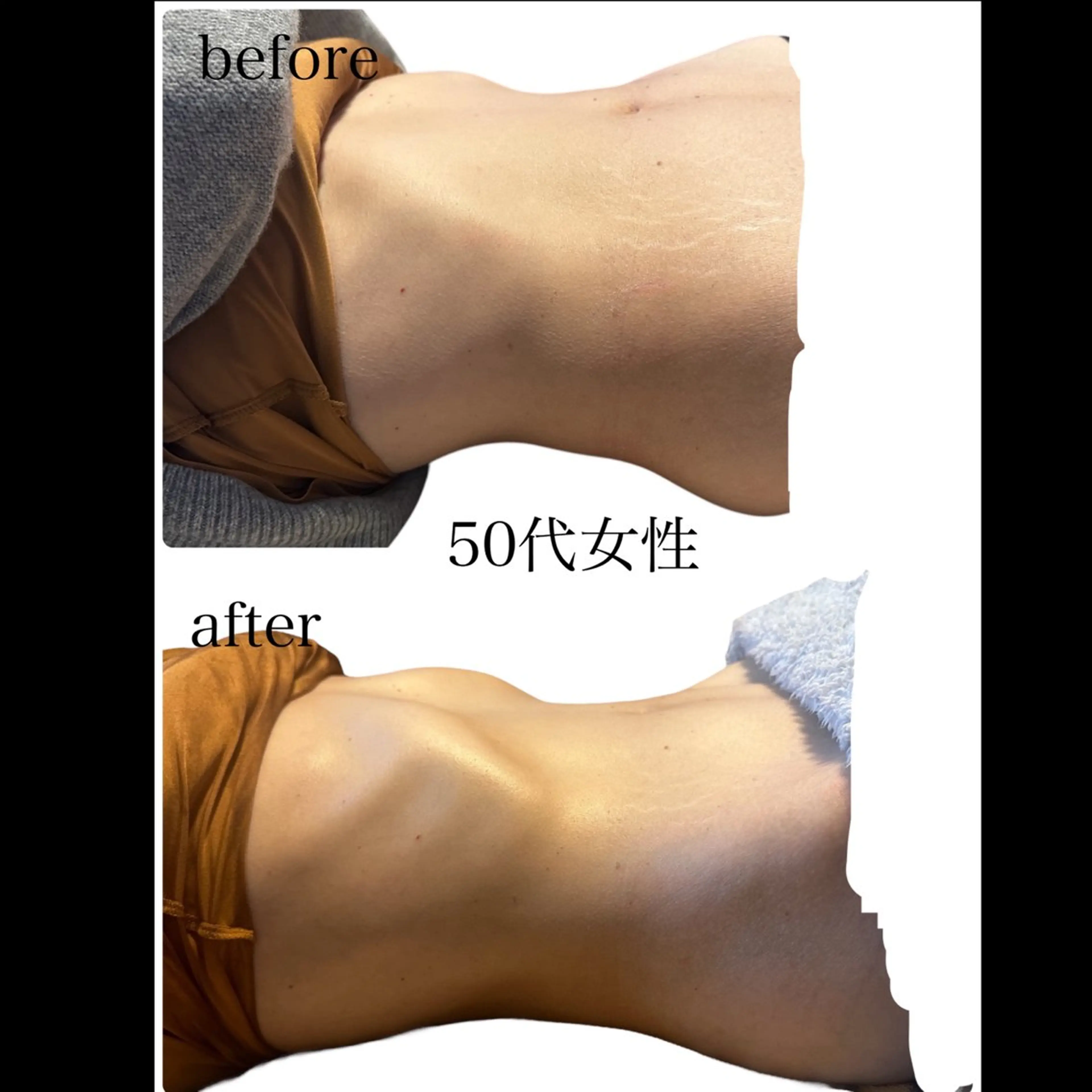 YOLO式腸もみ//圧倒的変化率No.1◆HOT腸もみ◆の写真