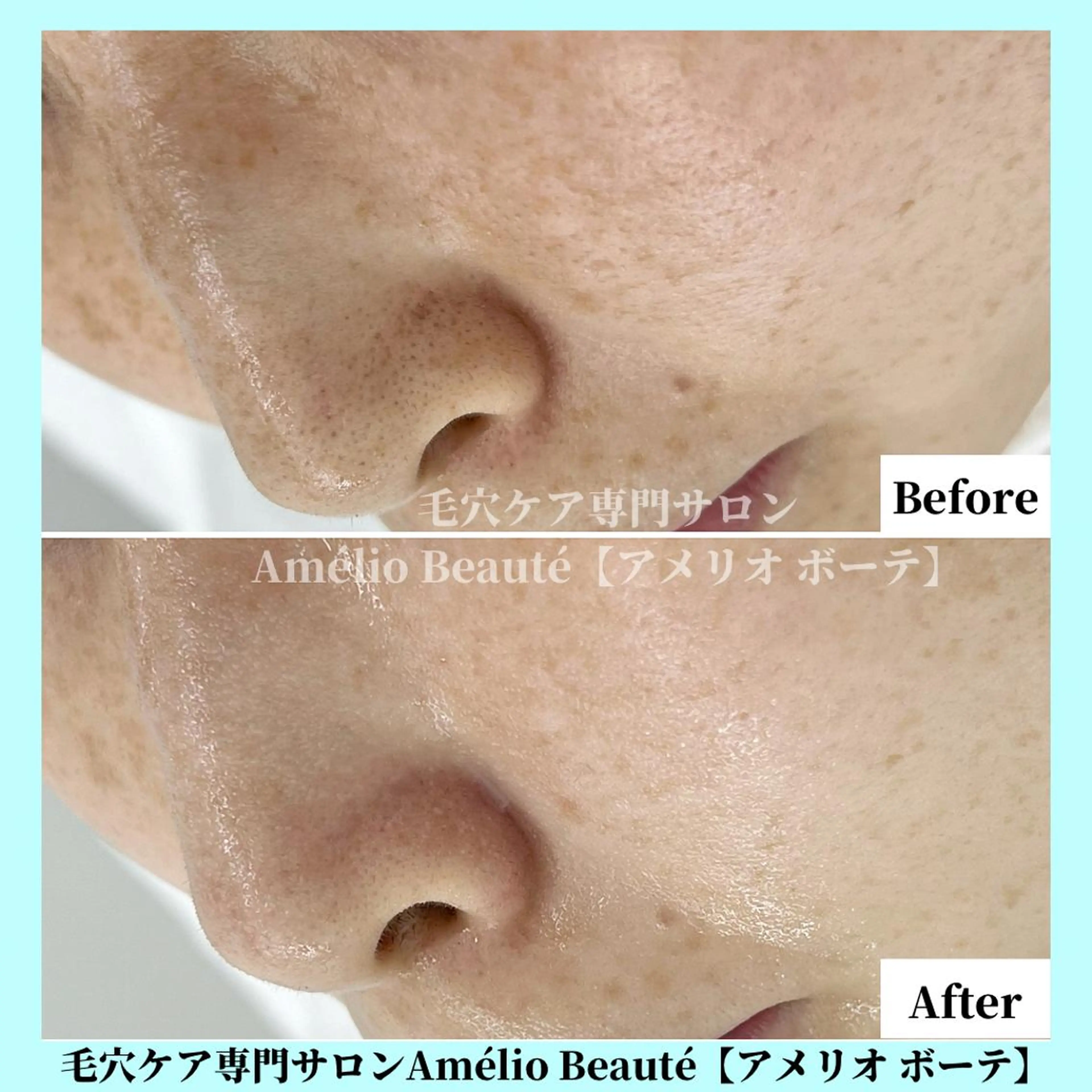 毛穴ケア専門サロン Amélio Beauté所属・毛穴ケア専門サロン アメリオボーテのその他イメージ