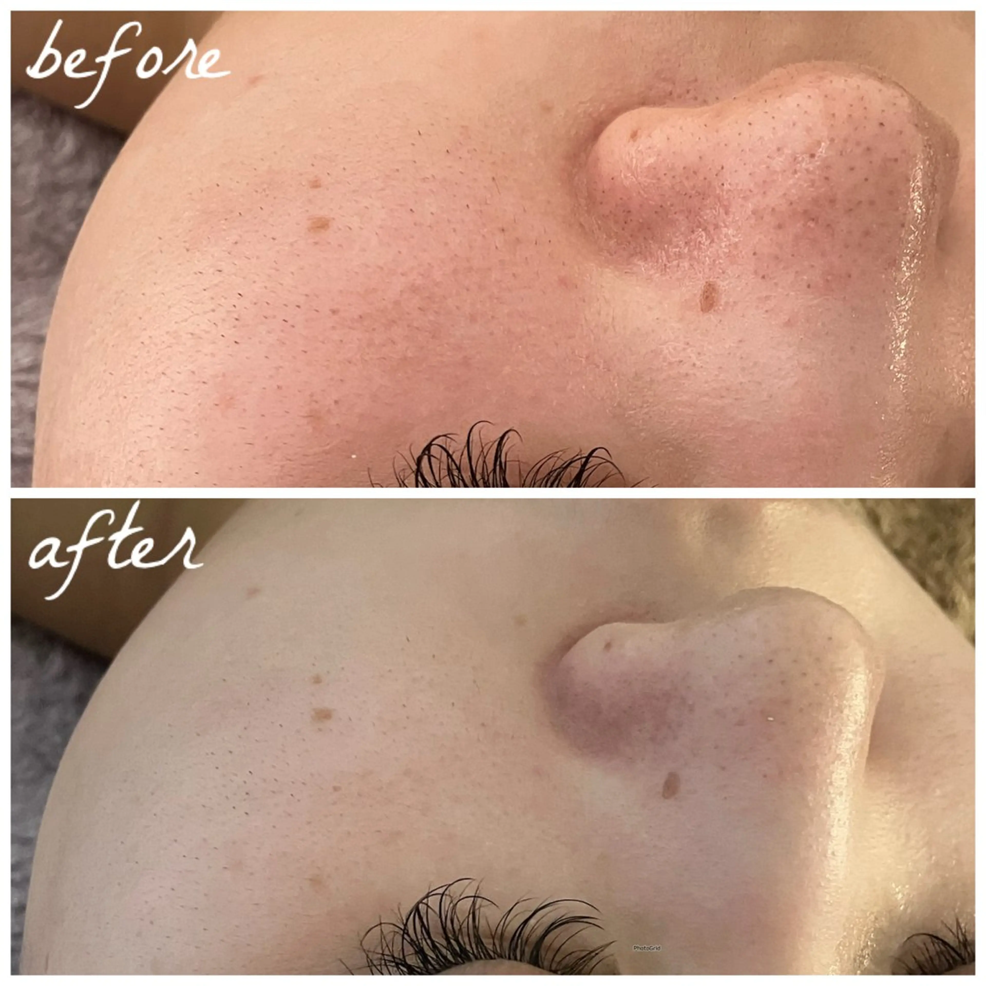 メンズ エステ メナード岐阜茜部 杉浦のエステ・リラクイメージ