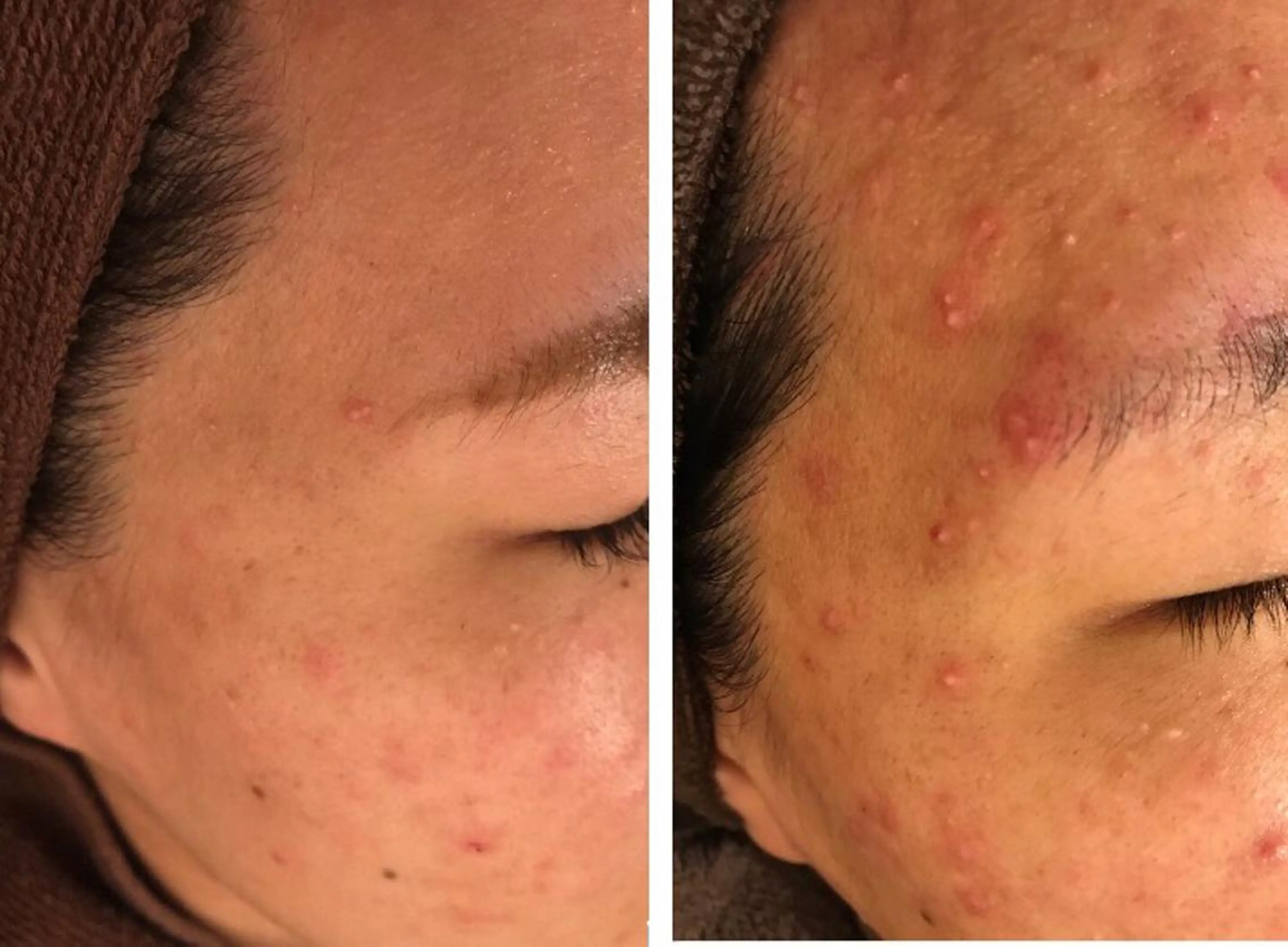 ミディアム カラー パーマ ヘアアレンジ メンズ キッズ ネイル マツエク・マツパ ニキビ・肌質改善専門 ♡人生が変わるサロンのエステ・リラクイメージ