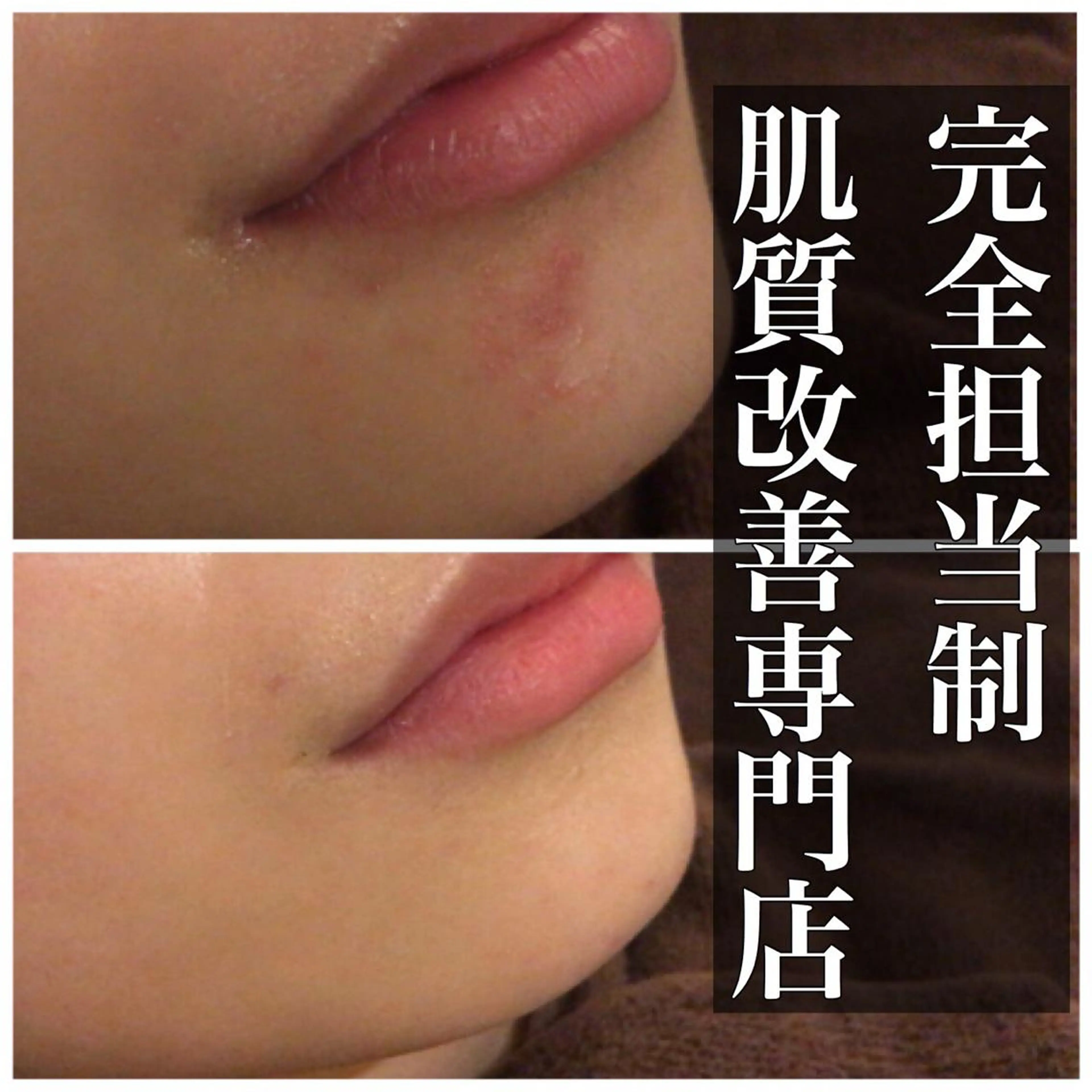 ミディアム カラー パーマ ヘアアレンジ メンズ キッズ ネイル マツエク・マツパ エステ リラク ニキビ・肌質改善専門 ♡人生が変わるサロンのエステ・リラクイメージ