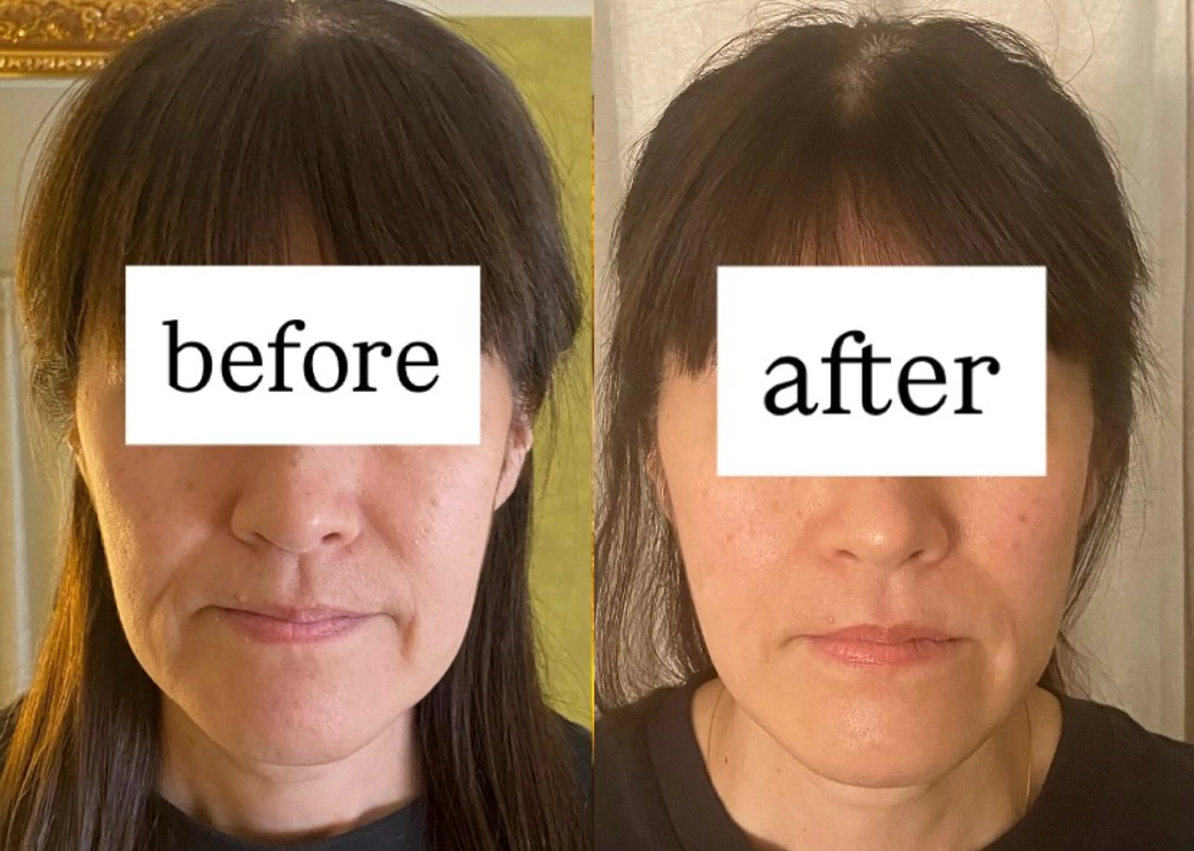 99-KUKU-所属・天神美容鍼99 -KUKU-吉弘萌香のエステ・リラクイメージ