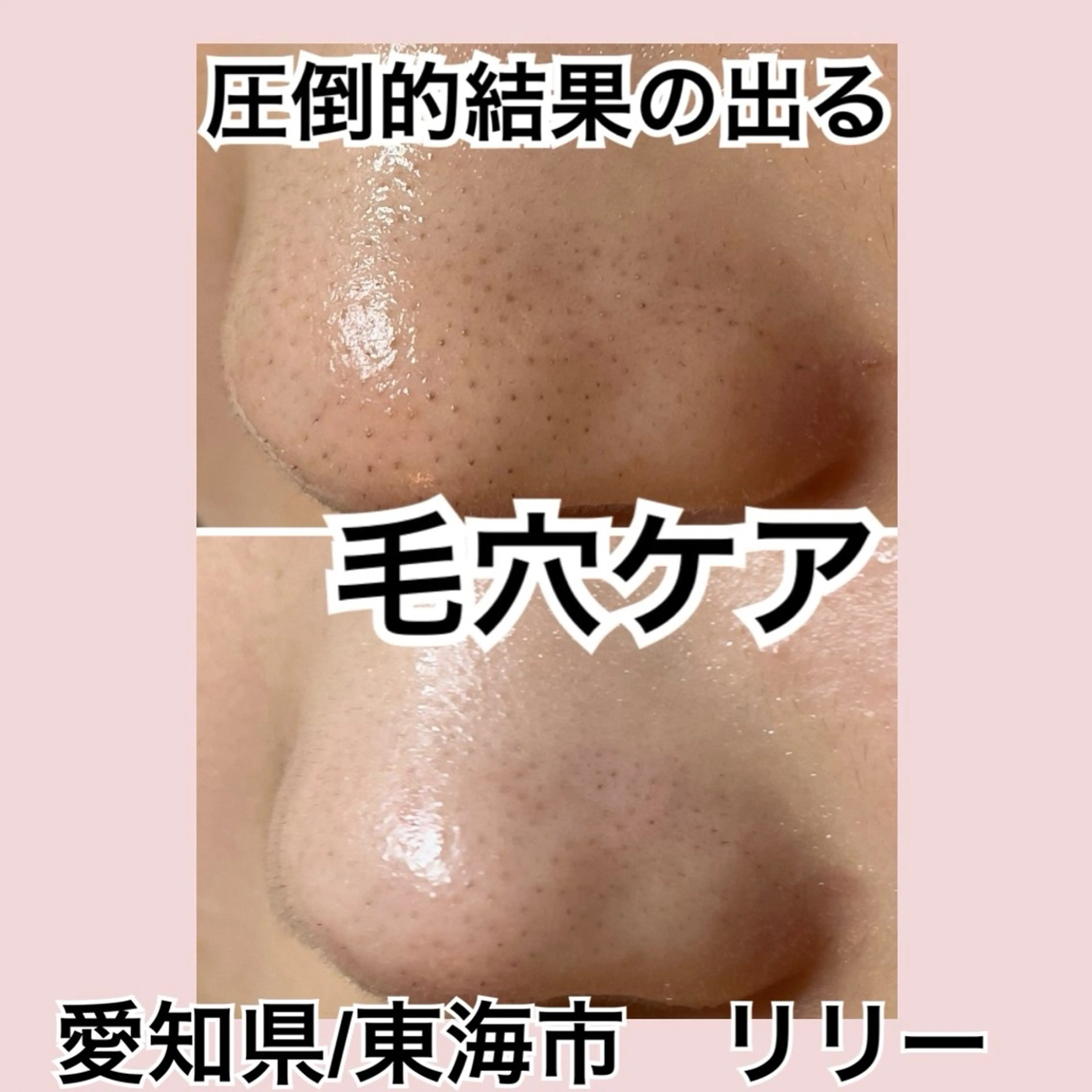 エステ リラク トータルビューティー サロンLilyのエステ・リラクイメージ