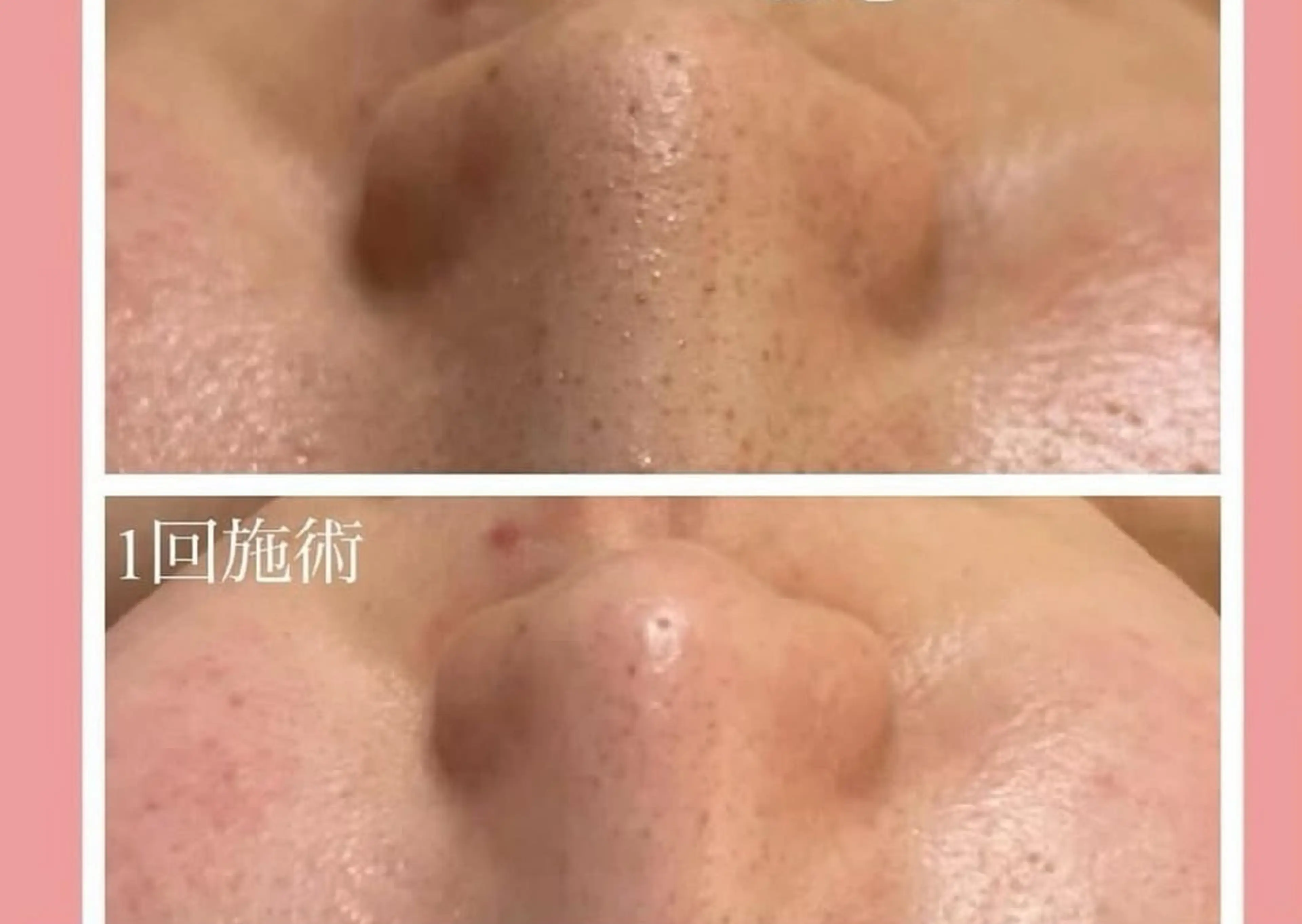 エイジングケアサロンBIOEL所属・肌質改善BIOELプ ラズマ/ラミピールのエステ・リラクイメージ