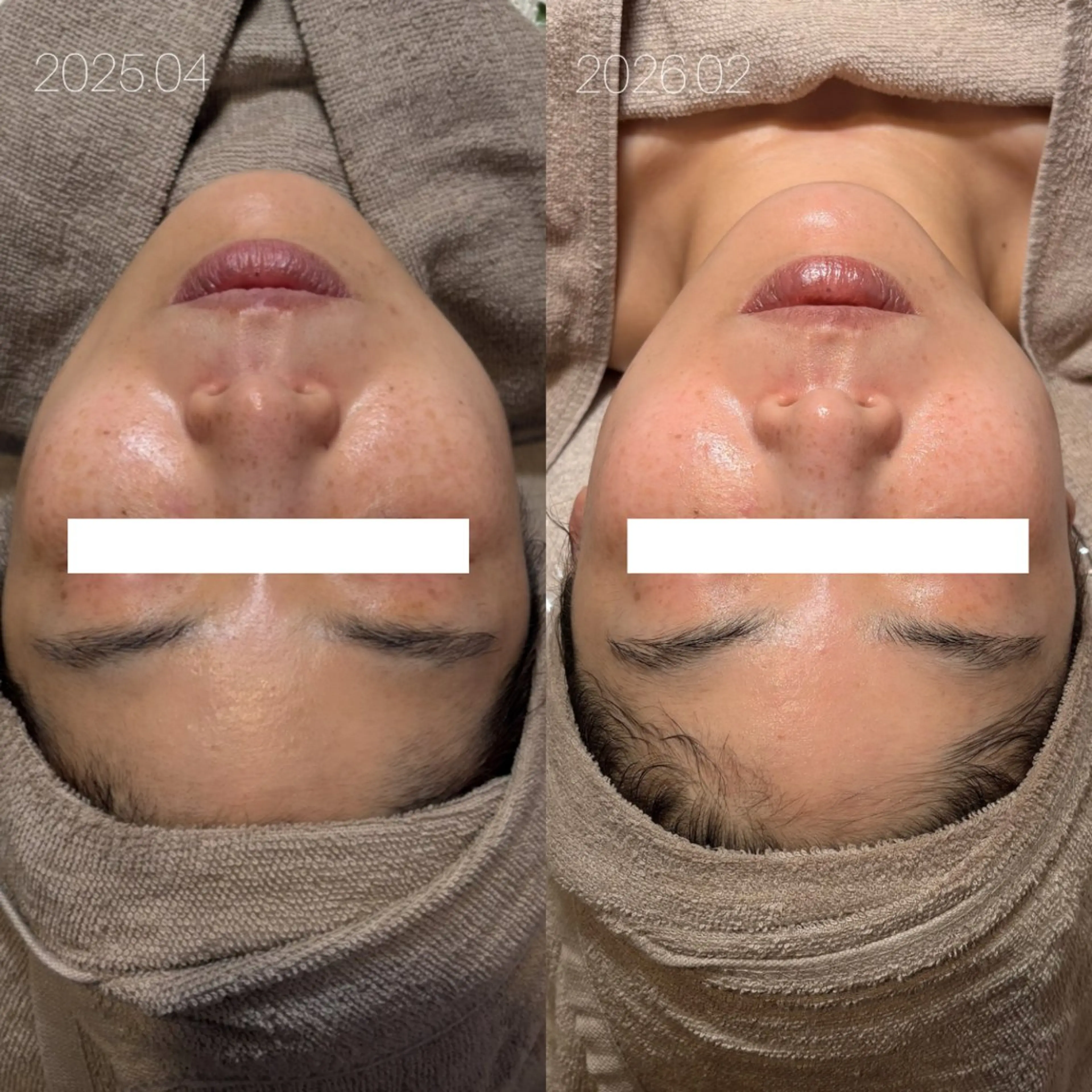 エステ Lassy Yuriの眉毛・アイブロウイメージ