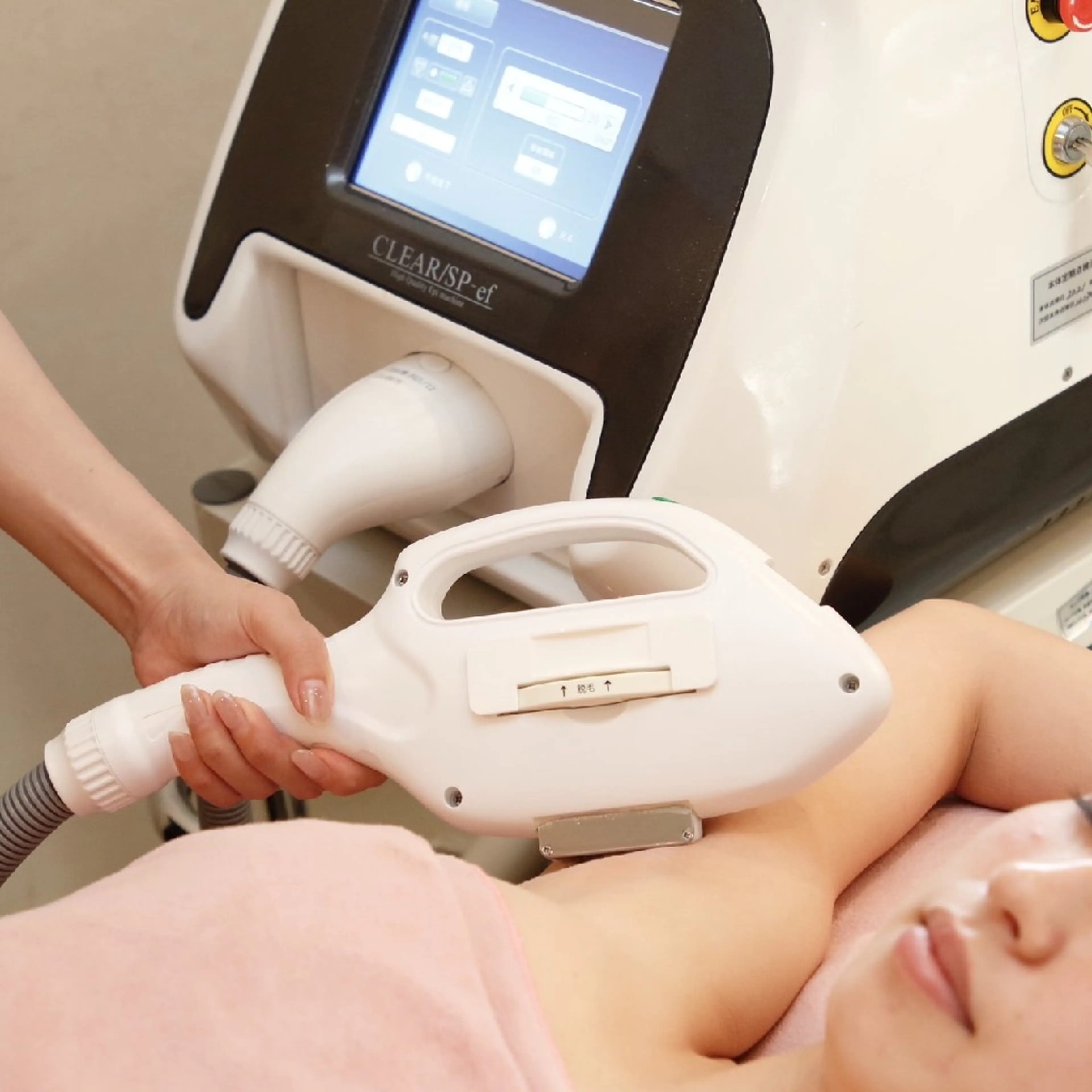 【今月のお勧め✨】約76%OFF☘️ 両脇脱毛1回の写真