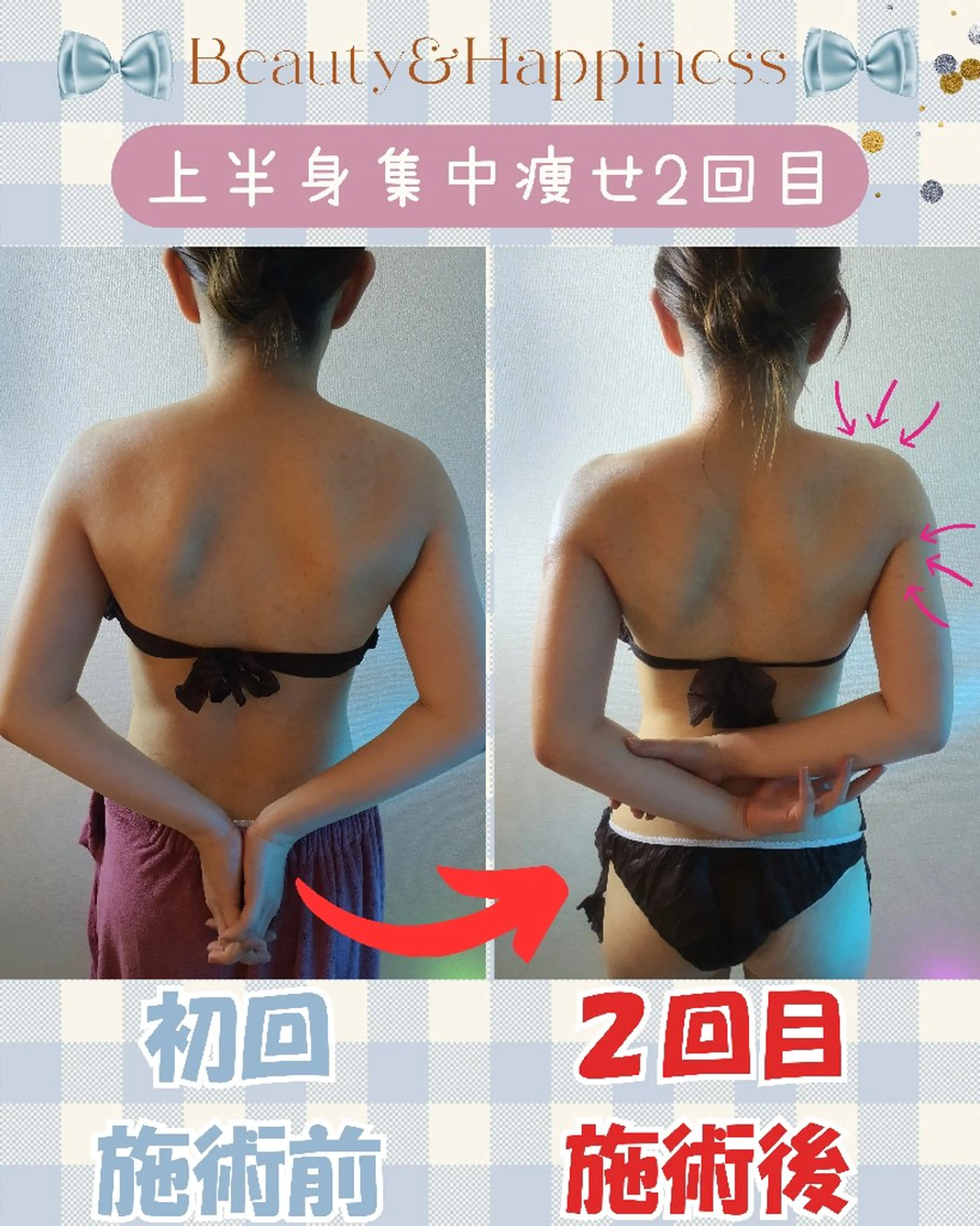 痩身ハーブピーリング 筋膜リリース☆B&Hのエステ・リラクイメージ