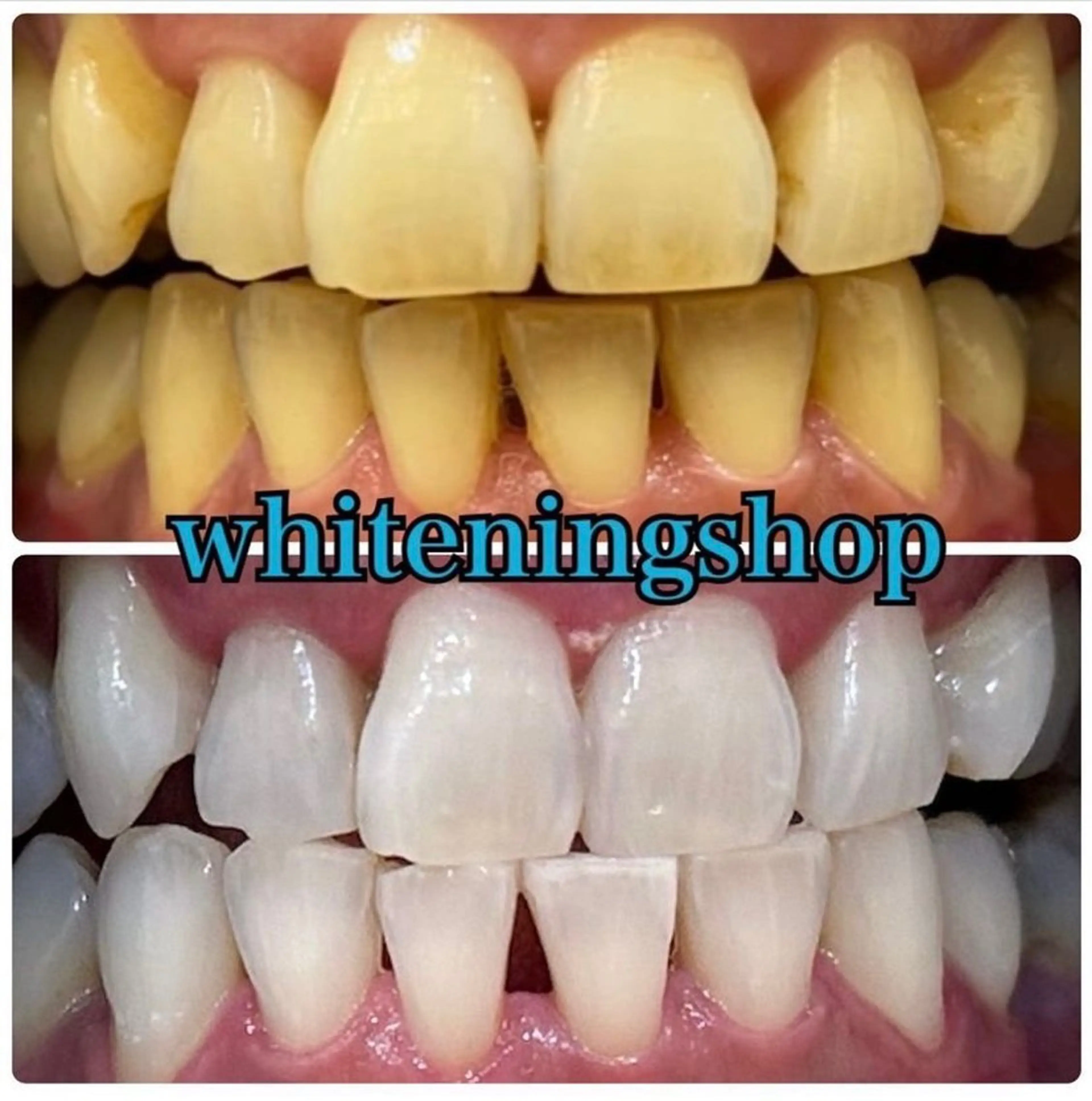 エステ リラク ホワイトニング ショップ吉祥寺店のエステ・リラクイメージ